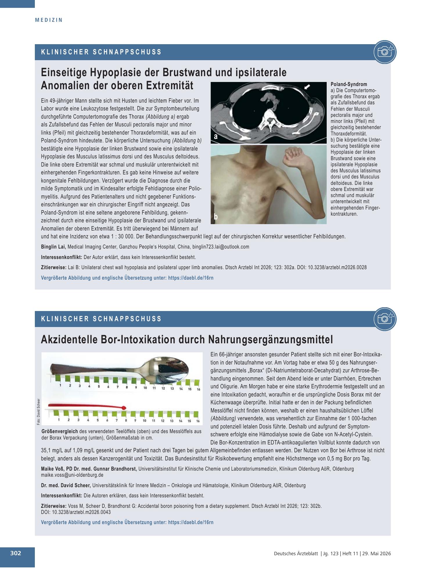 Vorschauseite 1: Einseitige Hypoplasie der Brustwand und ipsilaterale Anomalien der oberen Extremität – Deutsches Ärzteblatt