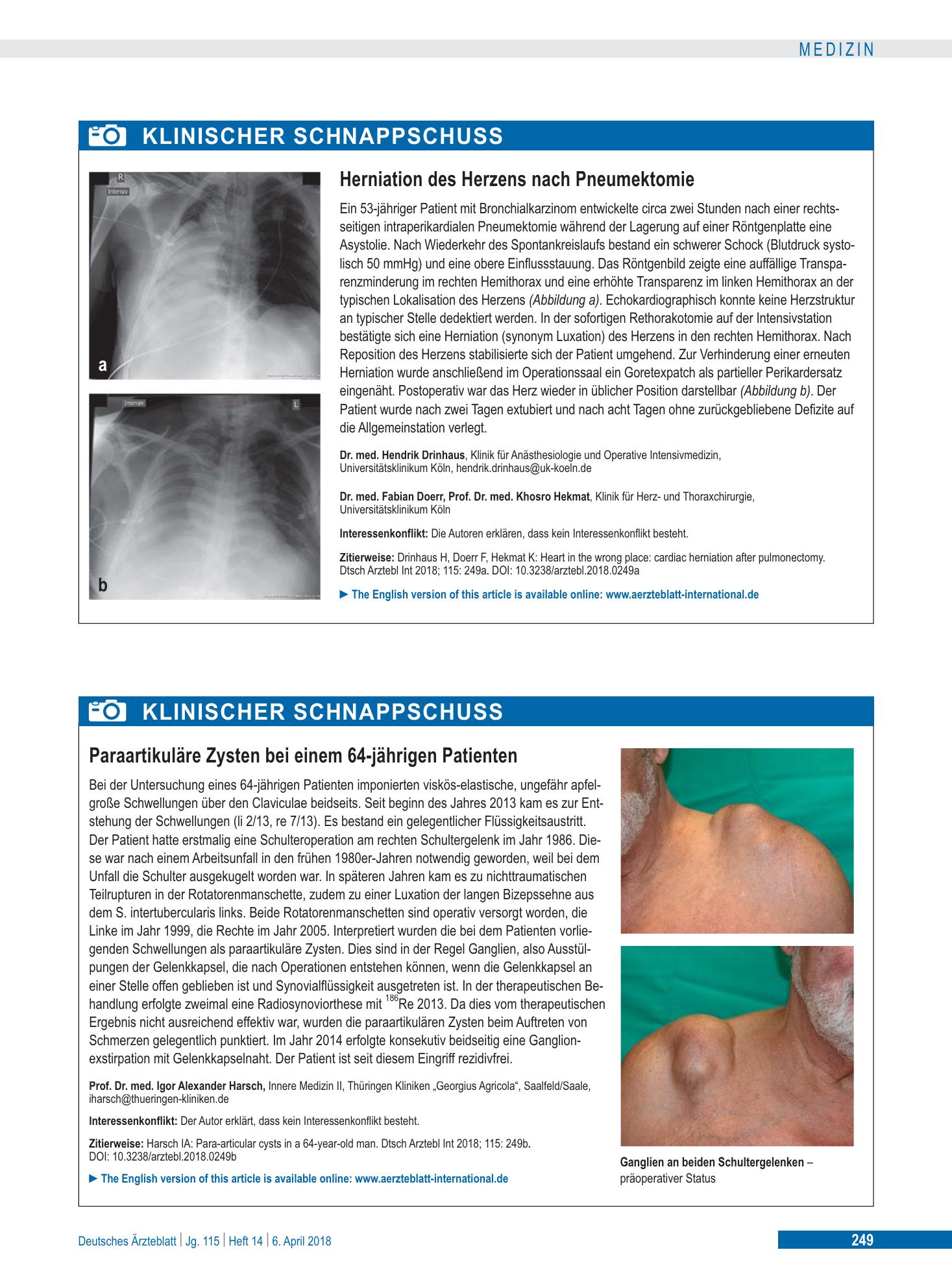 Vorschauseite 1: Herniation des Herzens nach Pneumektomie – Deutsches Ärzteblatt