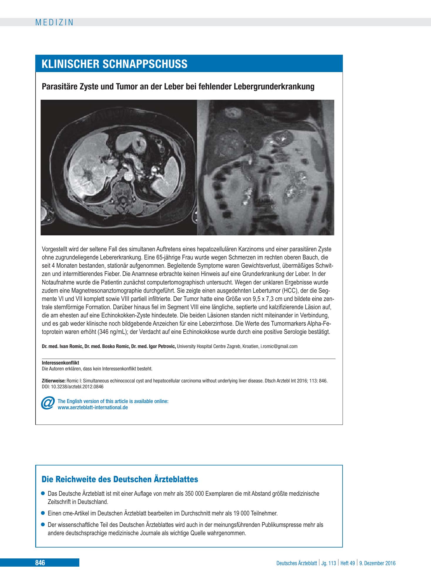Vorschauseite 1: Parasitäre Zyste und Tumor an der Leber bei fehlender Lebergrunderkrankung – Deutsches Ärzteblatt