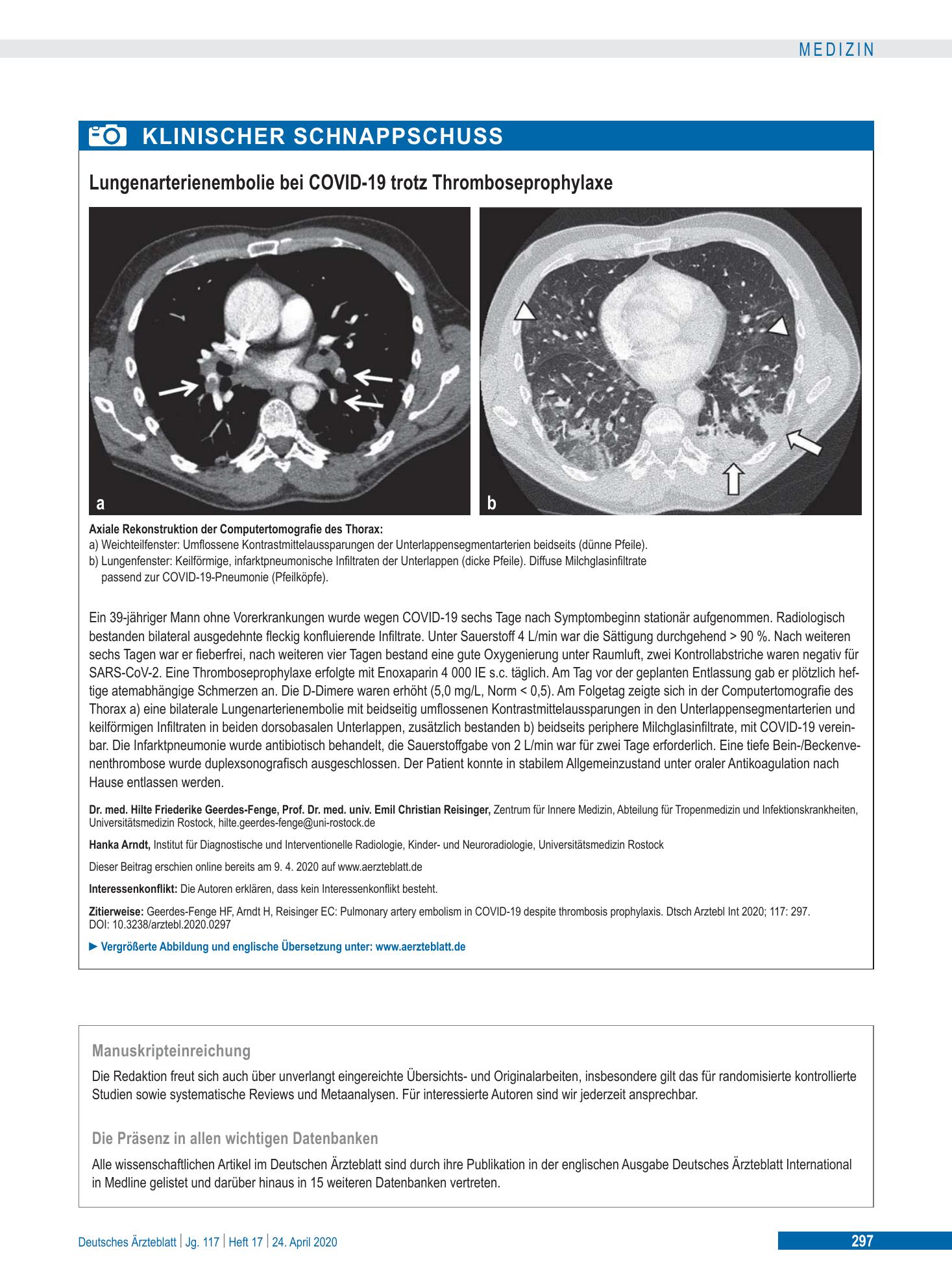 Vorschauseite 1: Lungenarterienembolie bei COVID-19 trotz Thromboseprophylaxe – Deutsches Ärzteblatt