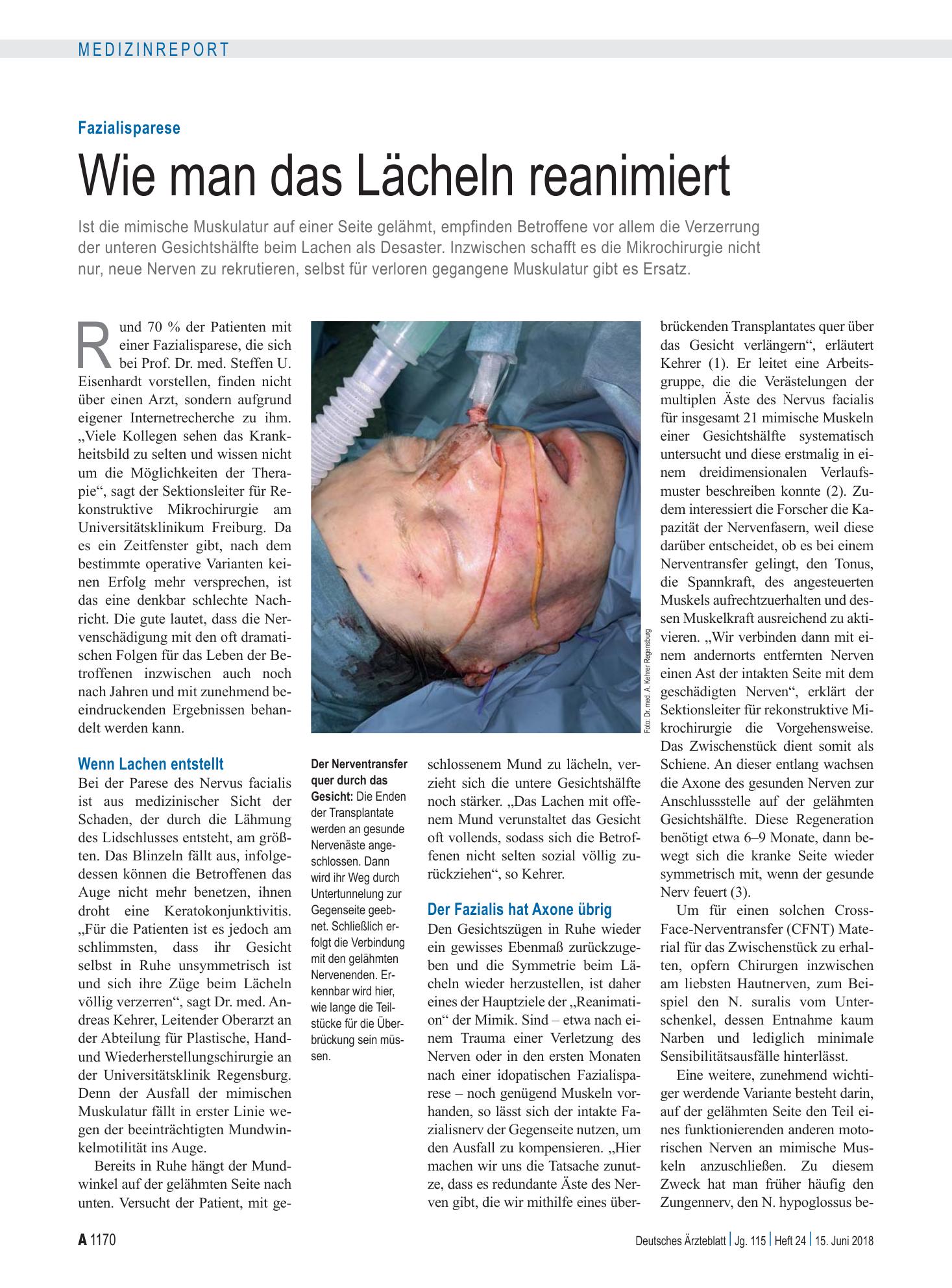 Vorschauseite 1: Fazialisparese: Wie man das Lächeln reanimiert – Deutsches Ärzteblatt