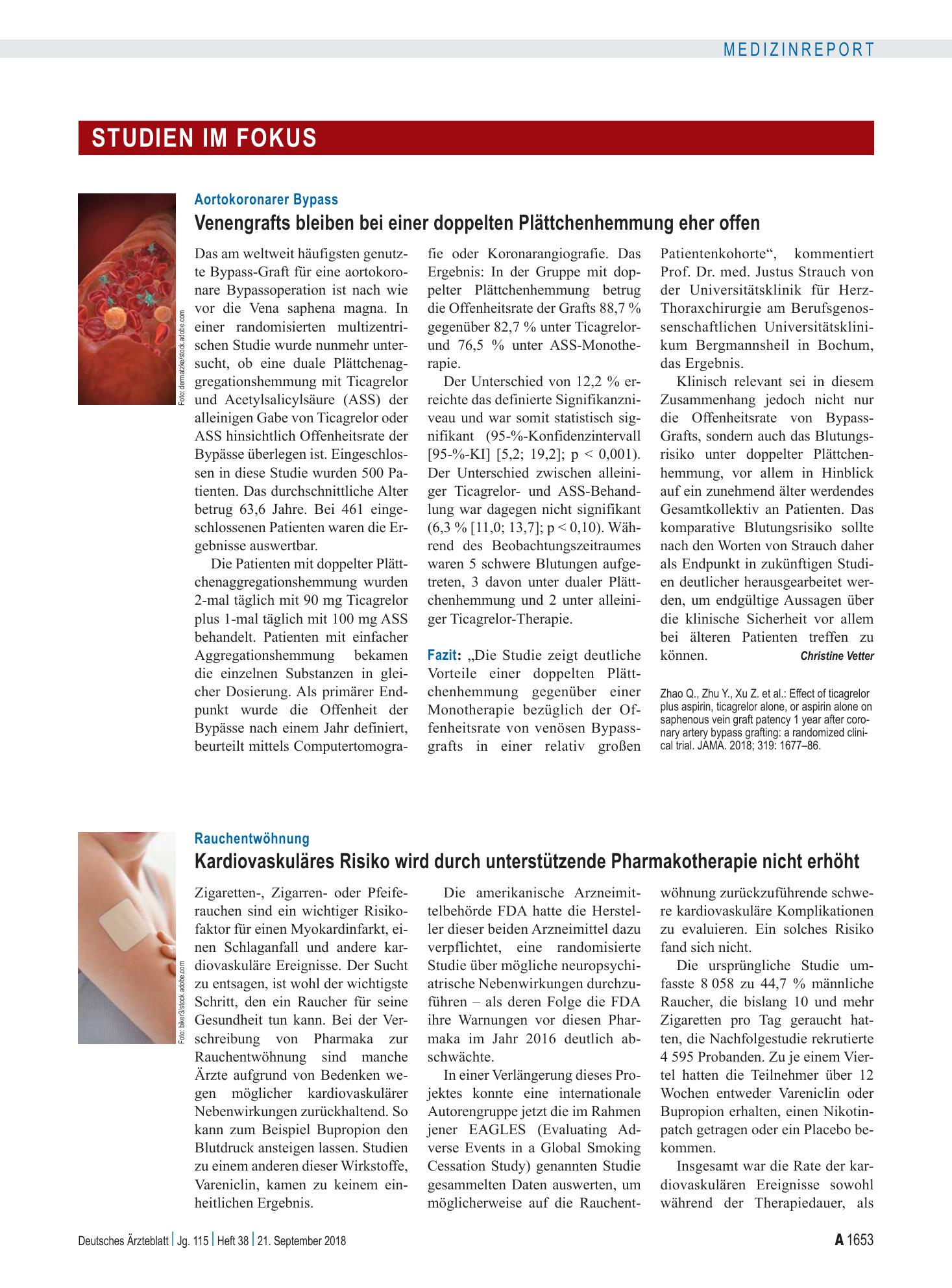 Vorschauseite 1: Aortokoronarer Bypass: Venengrafts bleiben bei einer doppelten Plättchenhemmung eher offen – Deutsches Ärzteblatt