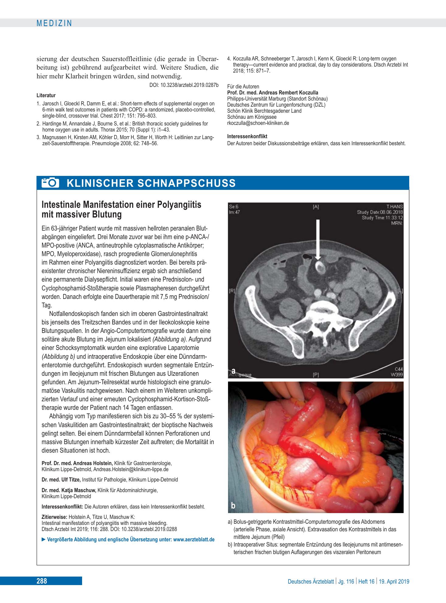 Vorschauseite 1: Intestinale Manifestation einer Polyangiitis mit massiver Blutung – Deutsches Ärzteblatt