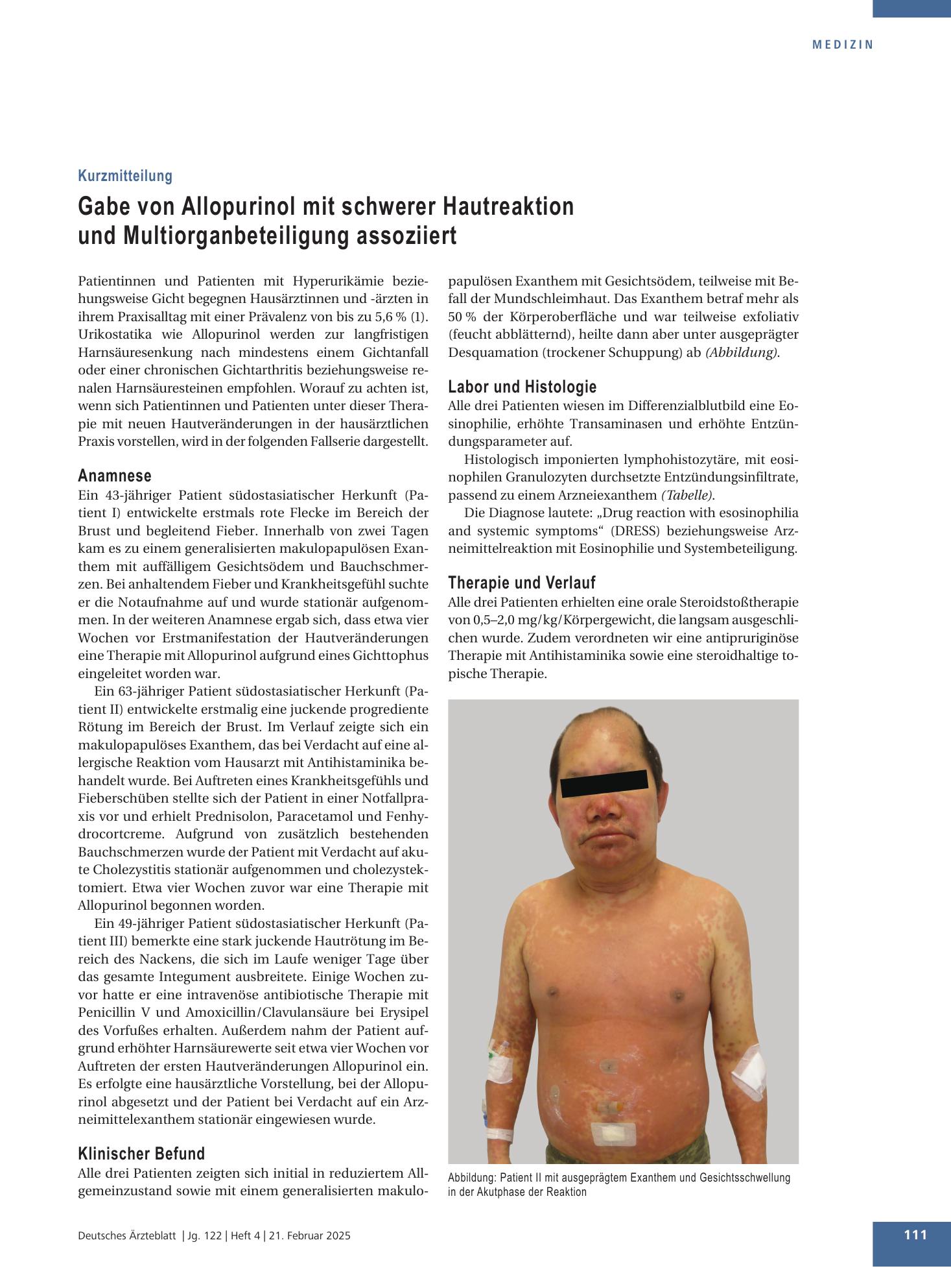 Vorschauseite 1: Gabe von Allopurinol mit schwerer Hautreaktion und Multiorganbeteiligung assoziiert – Deutsches Ärzteblatt
