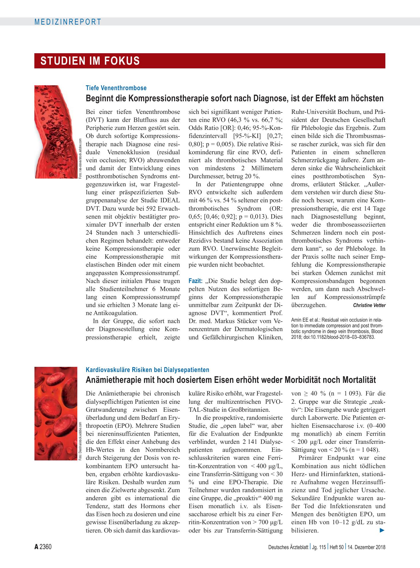 Vorschauseite 1: Tiefe Venenthrombose: Beginnt die Kompressionstherapie sofort nach Diagnose, ist der Effekt am höchsten – Deutsches Ärzteblatt