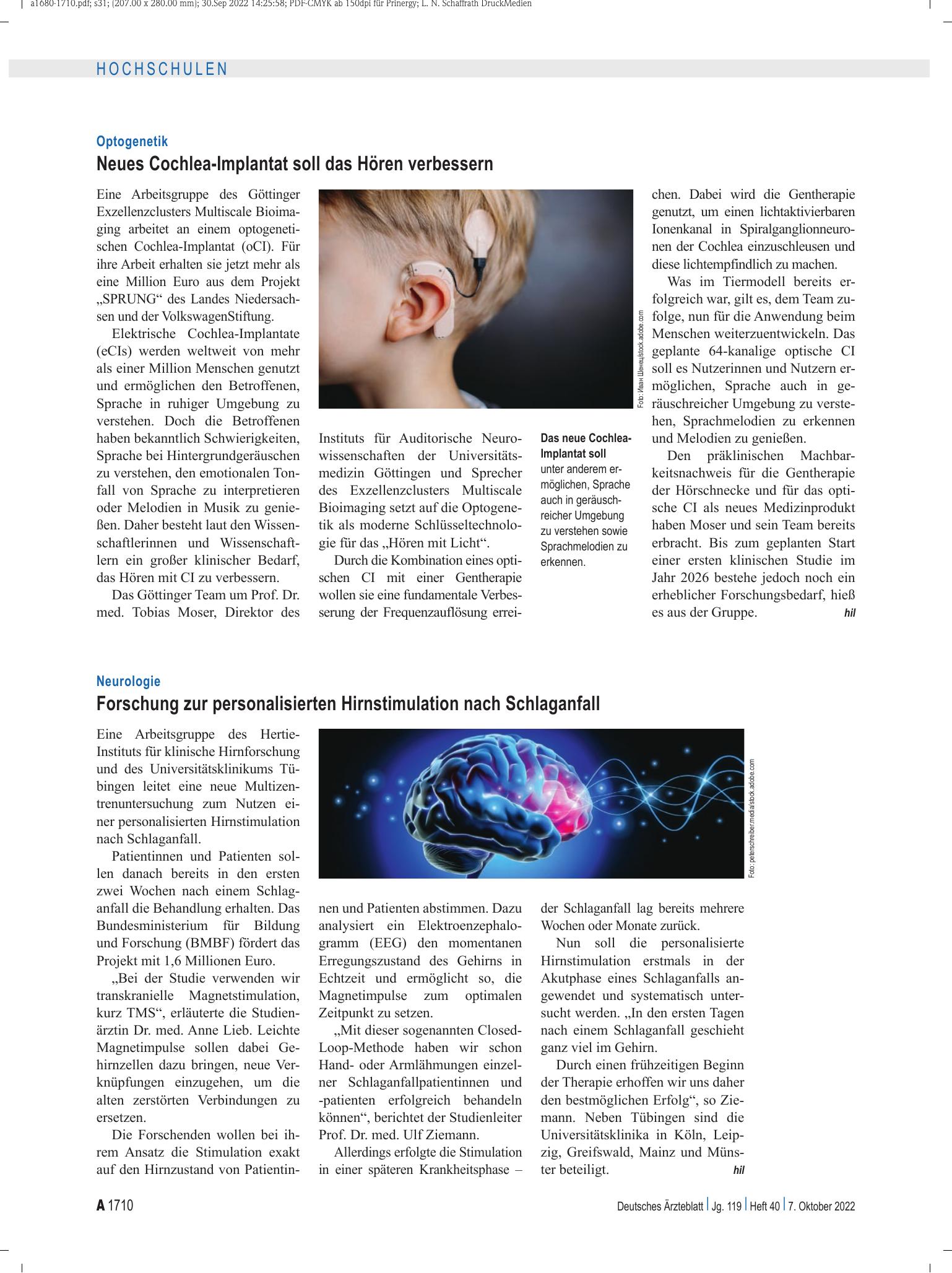 Vorschauseite 1: Neurologie: Forschung zur personalisierten Hirnstimulation nach Schlaganfall – Deutsches Ärzteblatt
