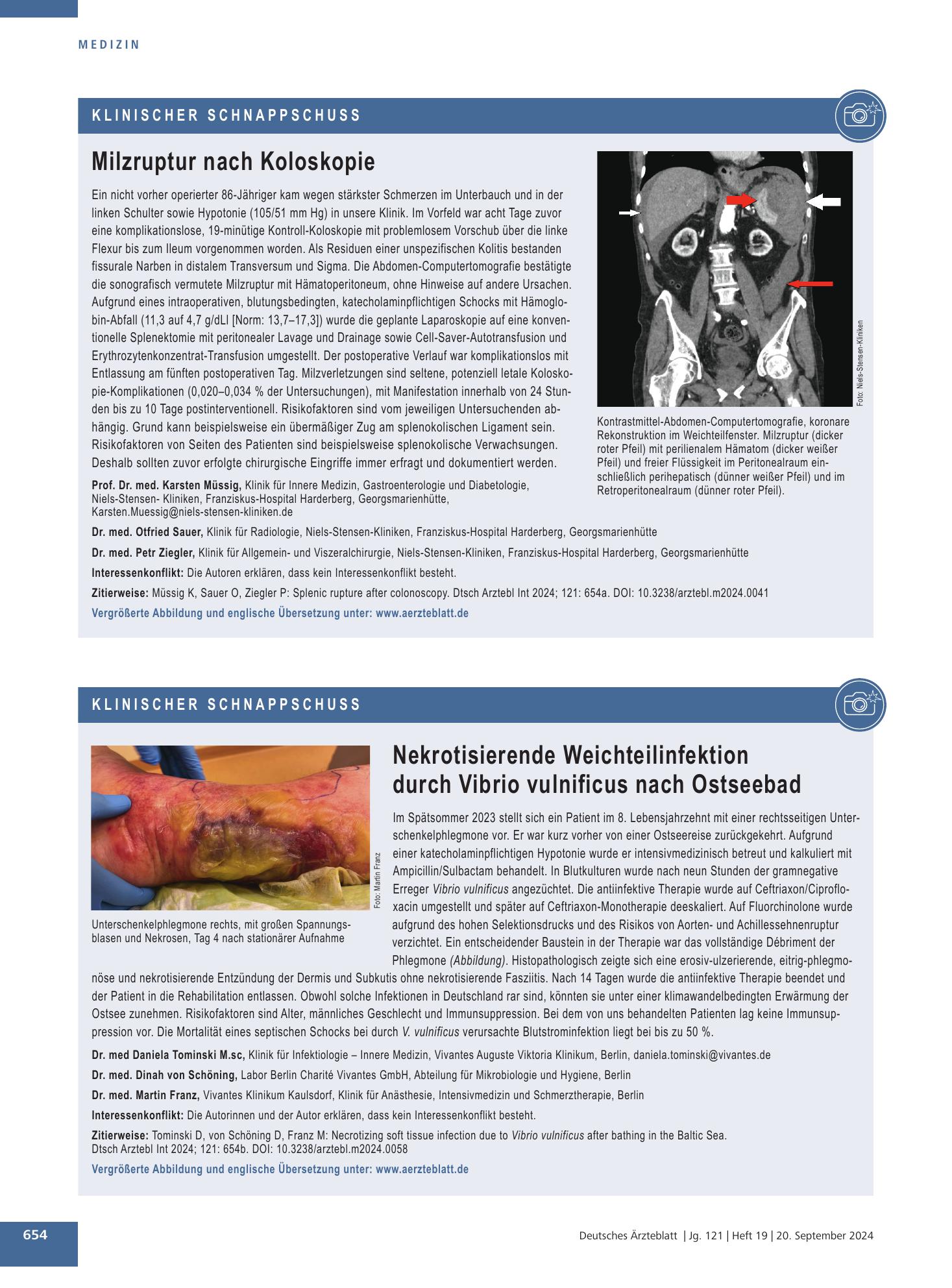 Vorschauseite 1: Milzruptur nach Koloskopie – Deutsches Ärzteblatt