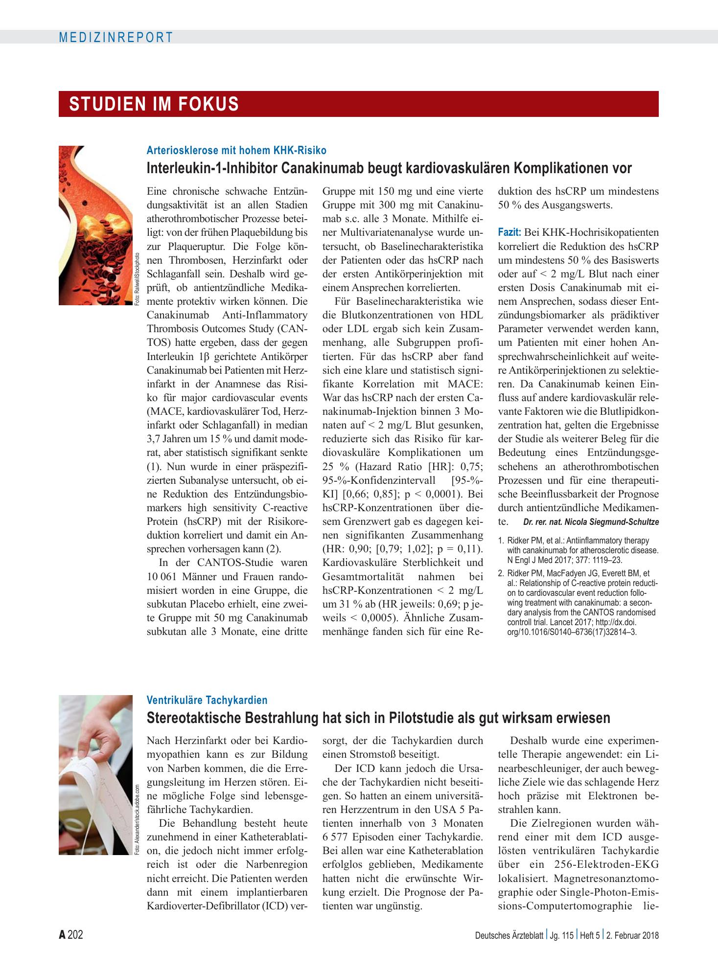 Vorschauseite 1: Ventrikuläre Tachykardien: Stereotaktische Bestrahlung hat sich in Pilotstudie als gut wirksam erwiesen – Deutsches Ärzteblatt