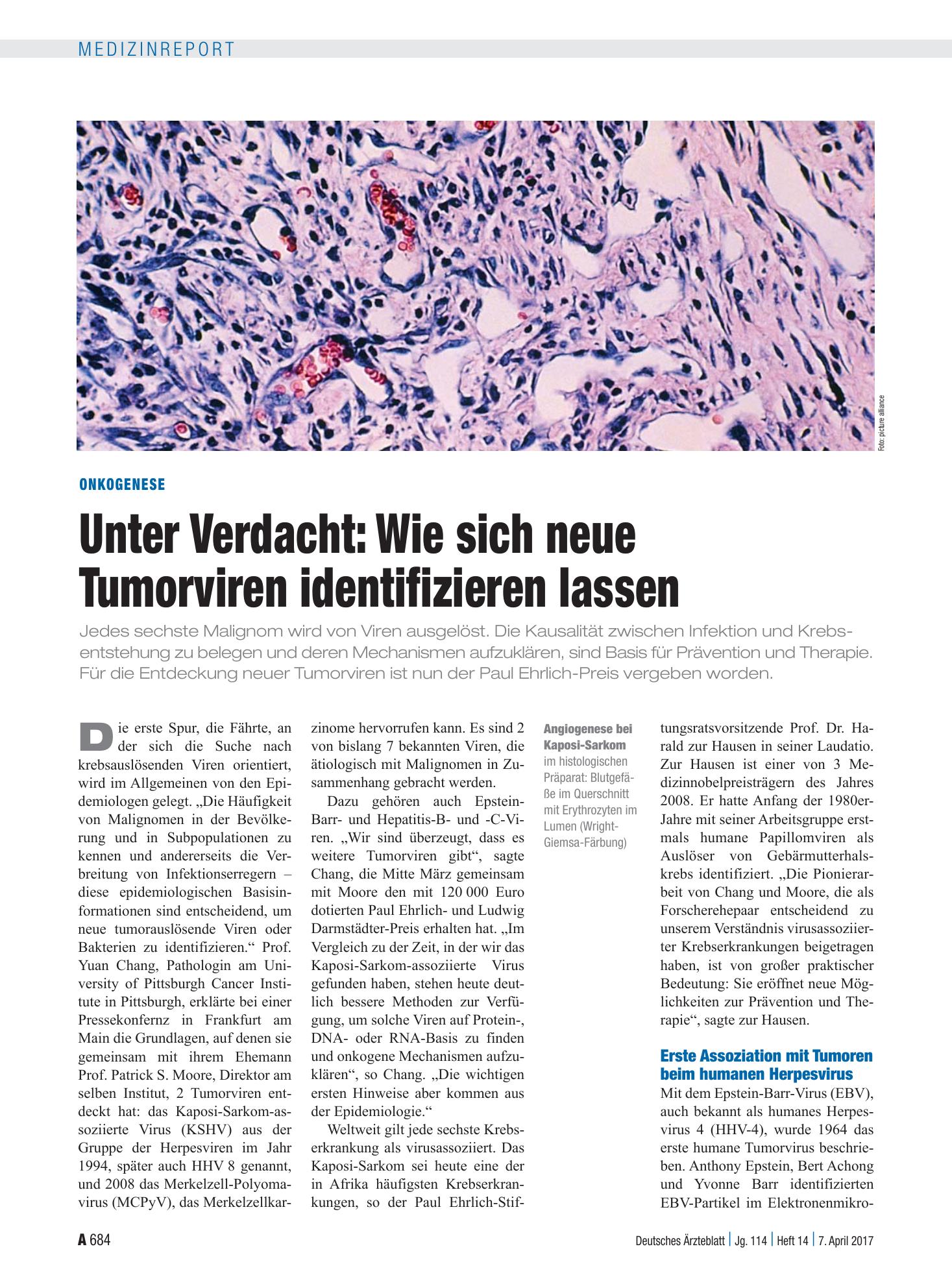 Vorschauseite 1: Onkogenese: Unter Verdacht – Wie sich neue Tumorviren identifizieren lassen – Deutsches Ärzteblatt