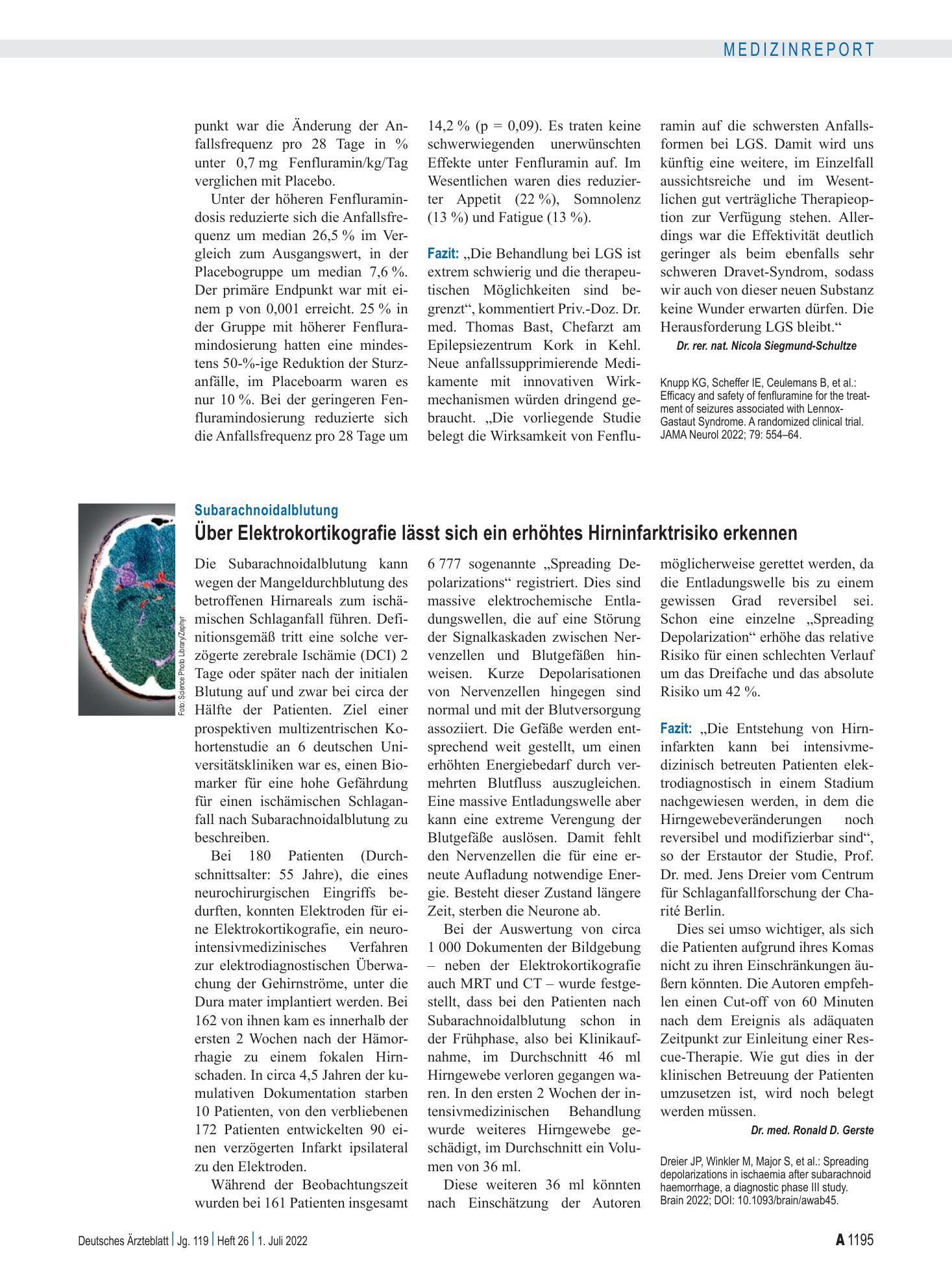 Vorschauseite 1: Subarachnoidalblutung: Über Elektrokortikografie lässt sich ein erhöhtes Hirninfarktrisiko erkennen – Deutsches Ärzteblatt