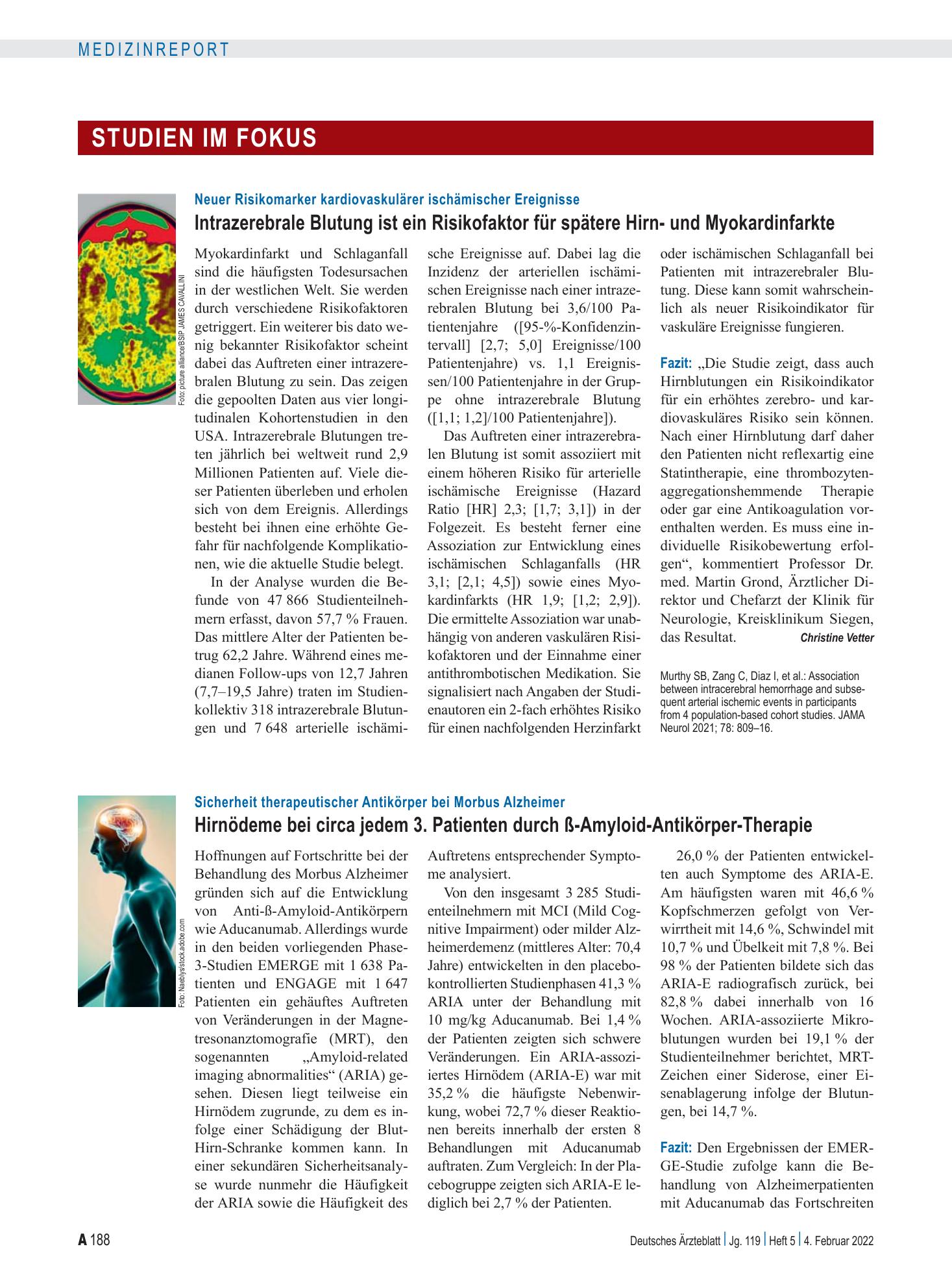 Vorschauseite 1: Neuer Risikomarker kardiovaskulärer ischämischer Ereignisse: Intrazerebrale Blutung ist ein Risikofaktor für spätere Hirn- und Myokardinfarkte – Deutsches Ärzteblatt