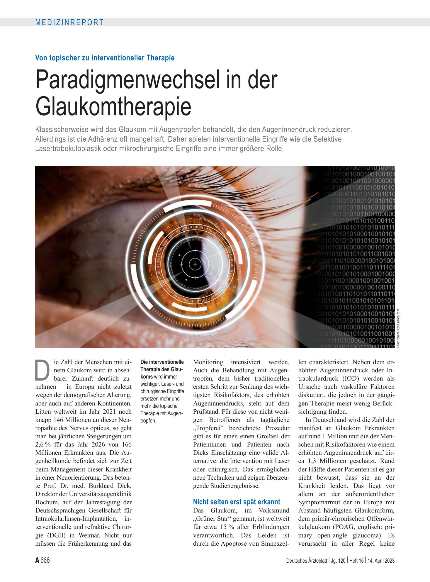Vorschauseite 1: Von topischer zu interventioneller Therapie: Paradigmenwechsel in der Glaukomtherapie – Deutsches Ärzteblatt