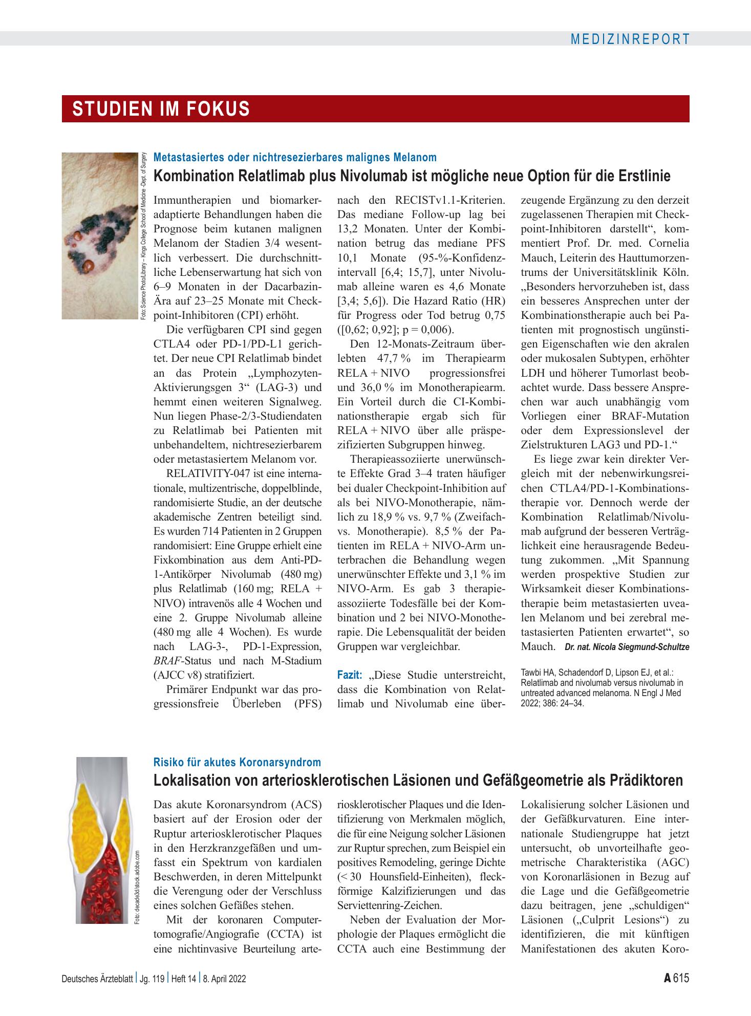 Vorschauseite 1: Metastasiertes oder nichtresezierbares malignes Melanom: Kombination Relatlimab plus Nivolumab ist mögliche neue Option für die Erstlinie – Deutsches Ärzteblatt
