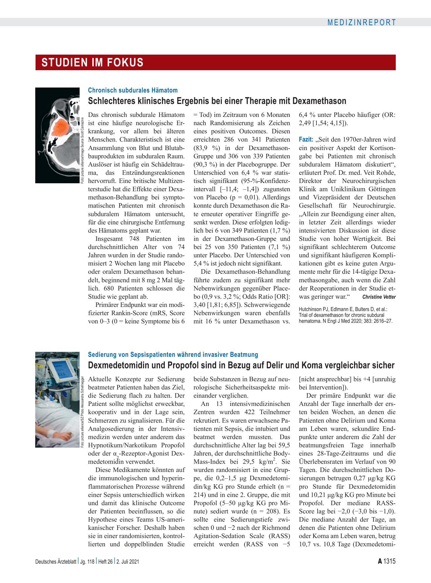 Vorschauseite 1: Chronisch subdurales Hämatom: Schlechteres klinisches Ergebnis bei einer Therapie mit Dexamethason – Deutsches Ärzteblatt