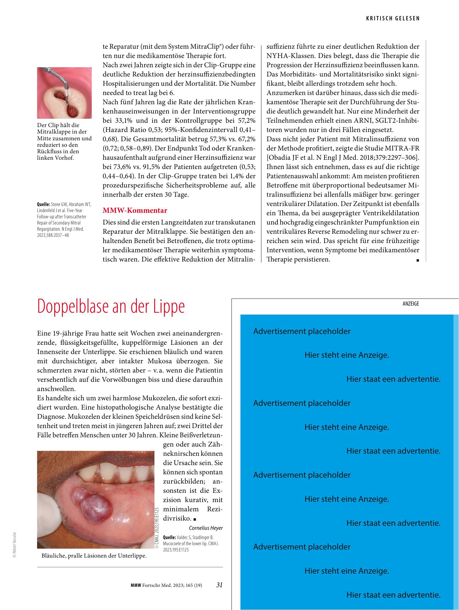 Vorschauseite 1: Doppelblase an der Lippe