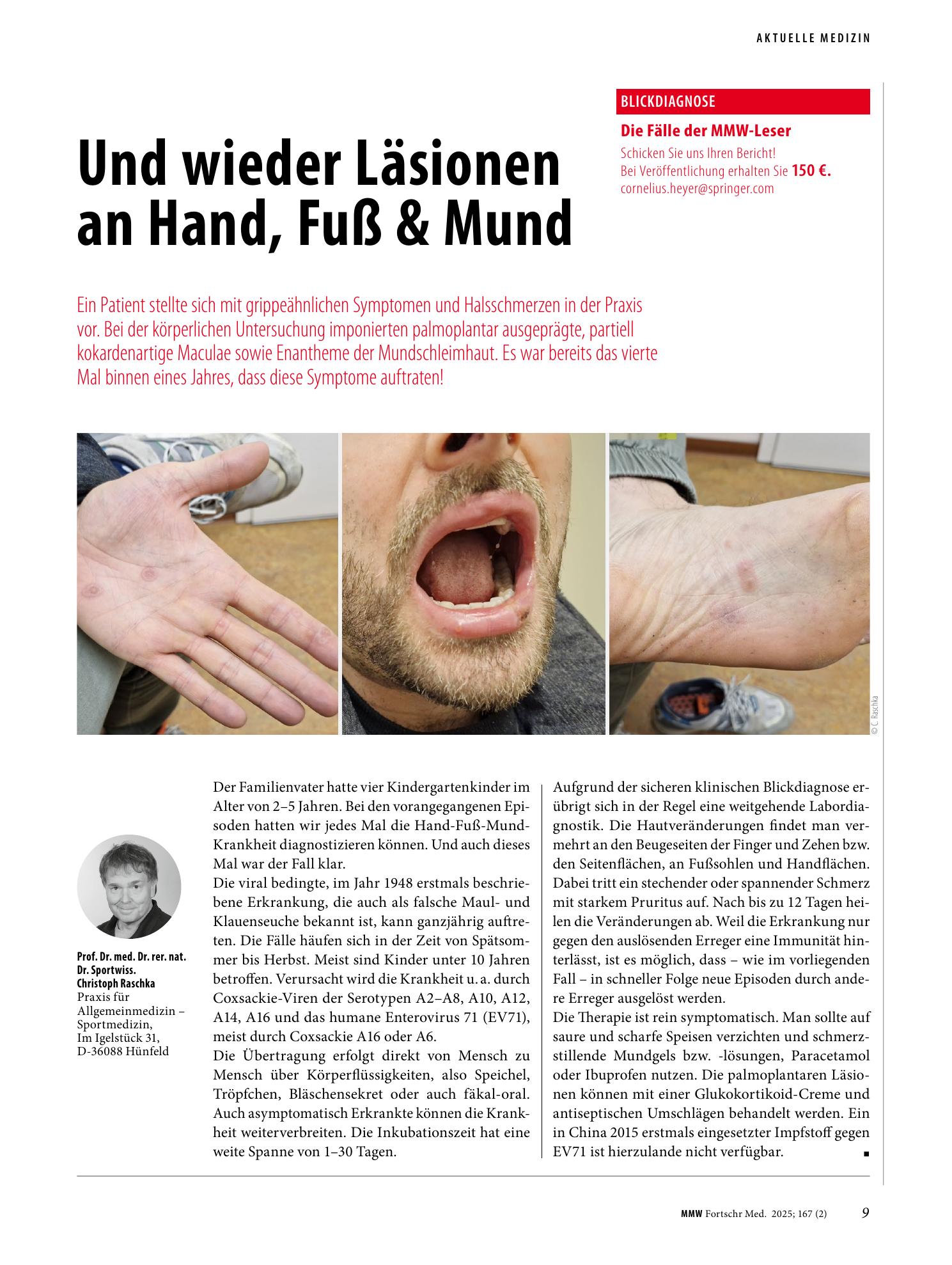 Vorschauseite 1: Und wieder Läsionen an Hand, Fuß & Mund