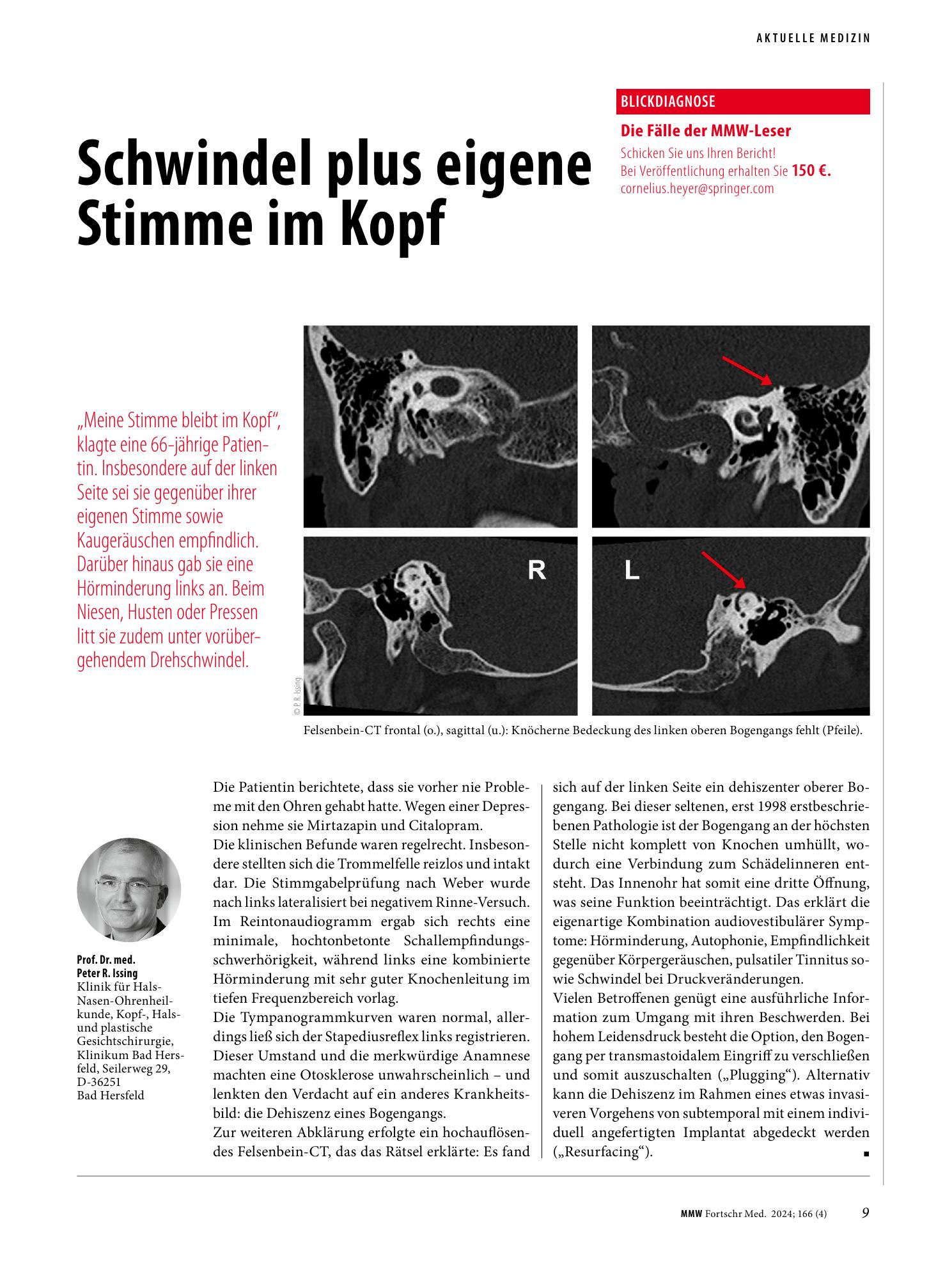 Vorschauseite 1: Schwindel plus eigene Stimme im Kopf