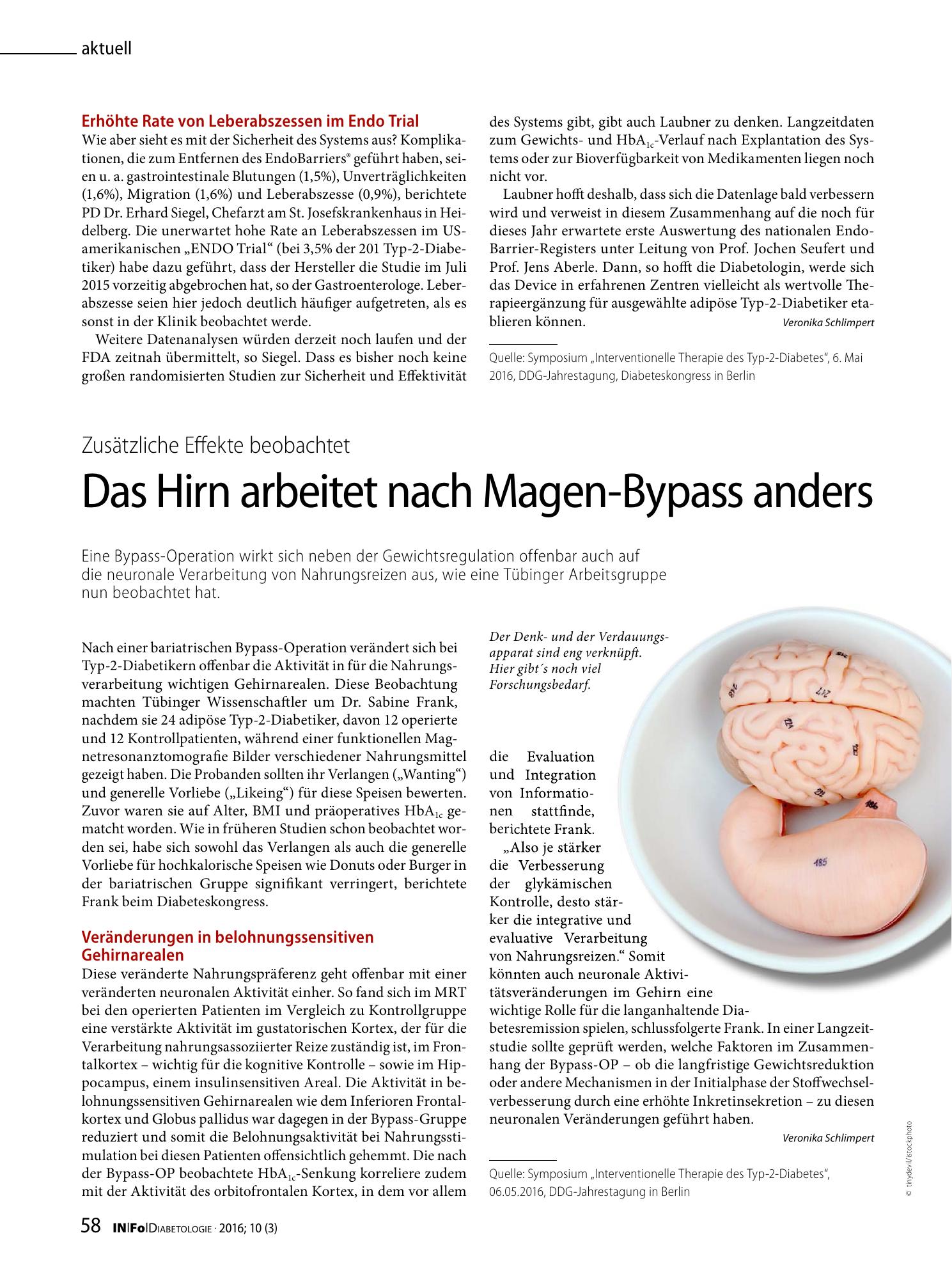 Vorschauseite 1: Das Hirn arbeitet nach Magen-Bypass anders