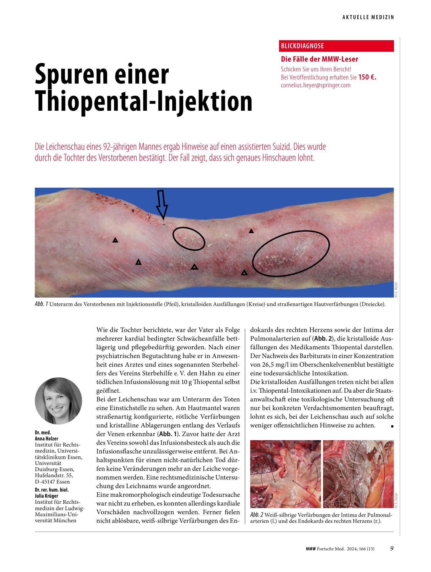 Vorschauseite 1: Spuren einer Thiopental-Injektion