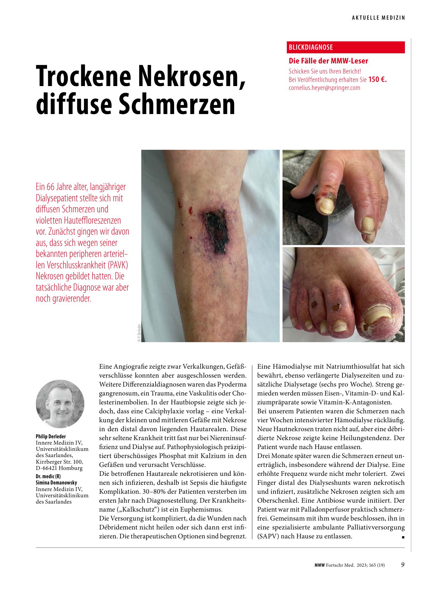 Vorschauseite 1: Trockene Nekrosen, diffuse Schmerzen