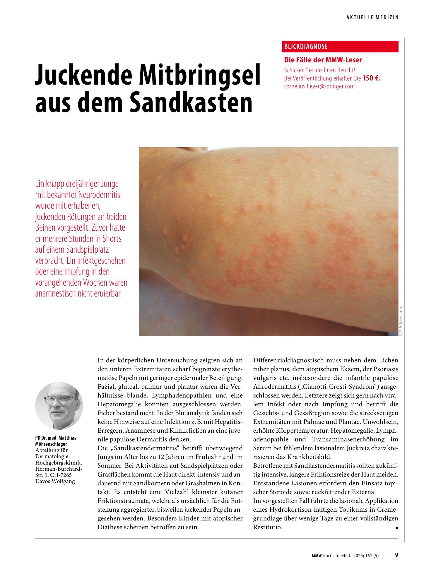 Vorschauseite 1: Juckende Mitbringsel aus dem Sandkasten
