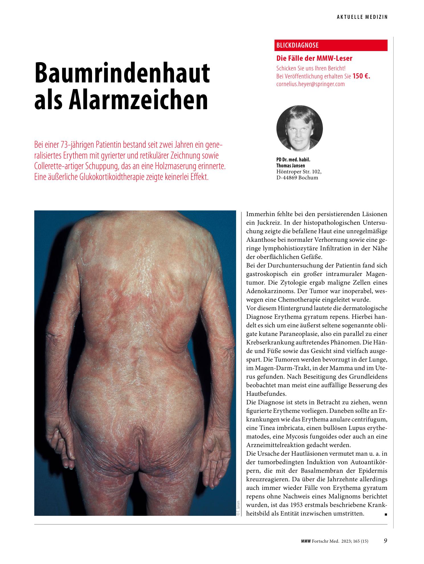 Vorschauseite 1: Baumrindenhaut als Alarmzeichen