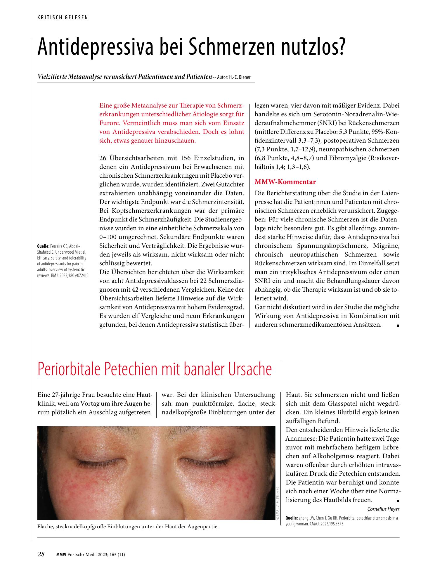 Vorschauseite 1: Antidepressiva bei Schmerzen nutzlos?