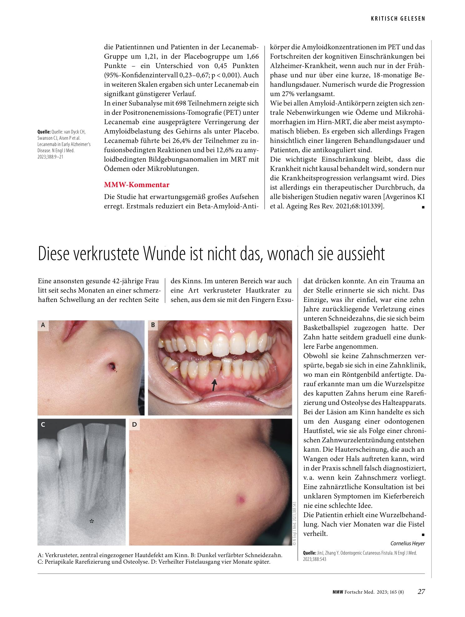 Vorschauseite 1: Diese verkrustete Wunde ist nicht das, wonach sie aussieht