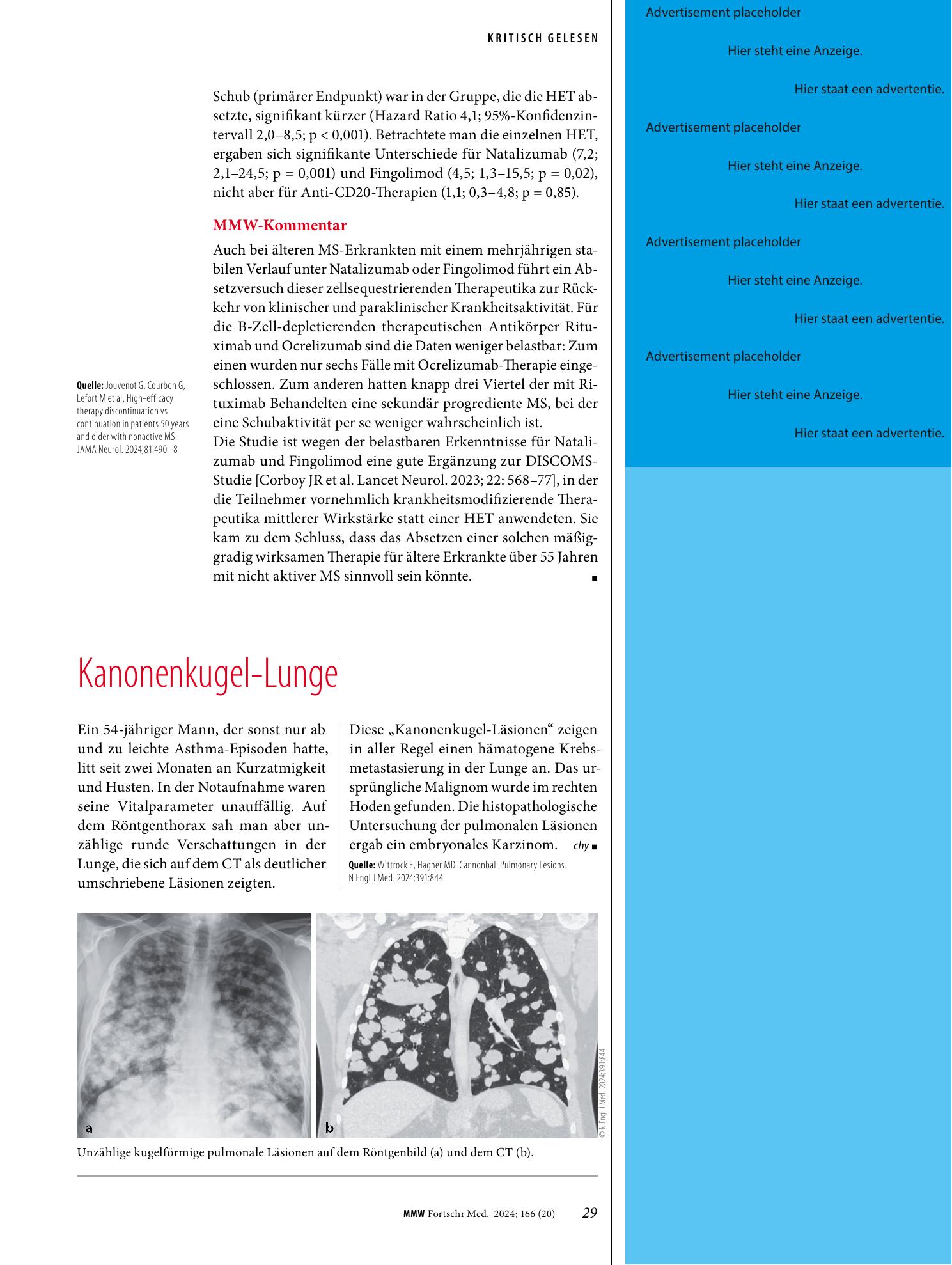 Vorschauseite 1: Kanonenkugel-Lunge