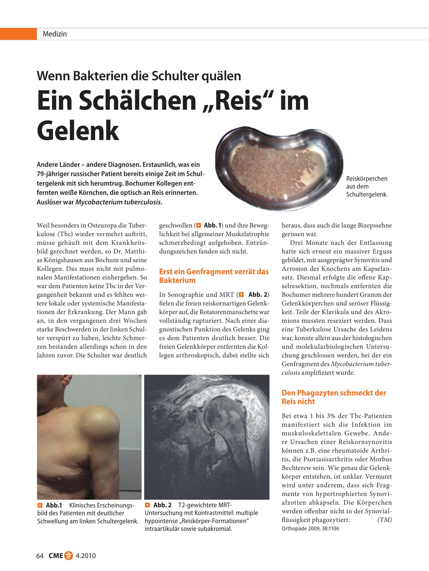 Vorschauseite 1: Ein Schälchen „Reis“ im Gelenk