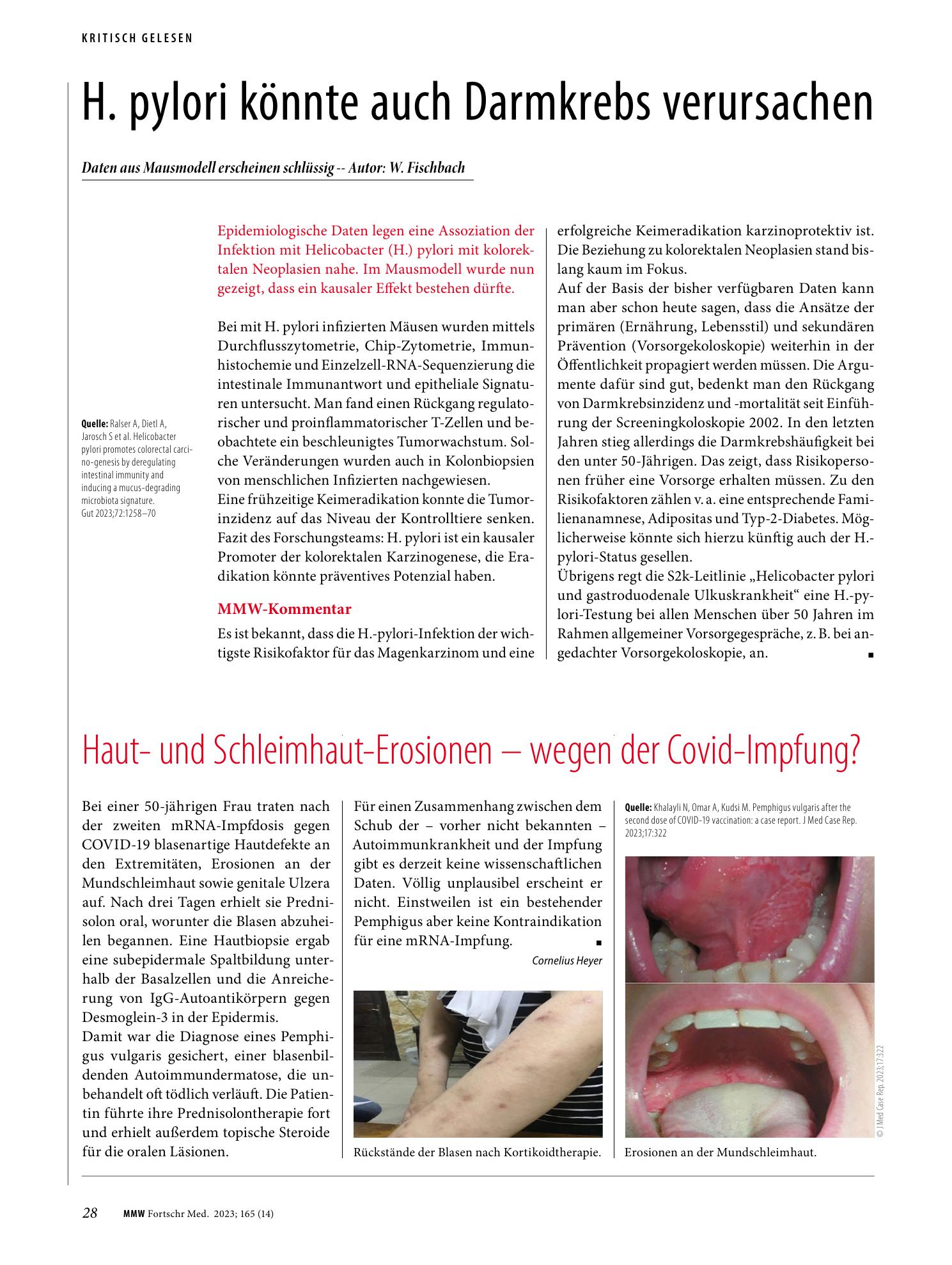 Vorschauseite 1: H. pylori könnte auch Darmkrebs verursachen
