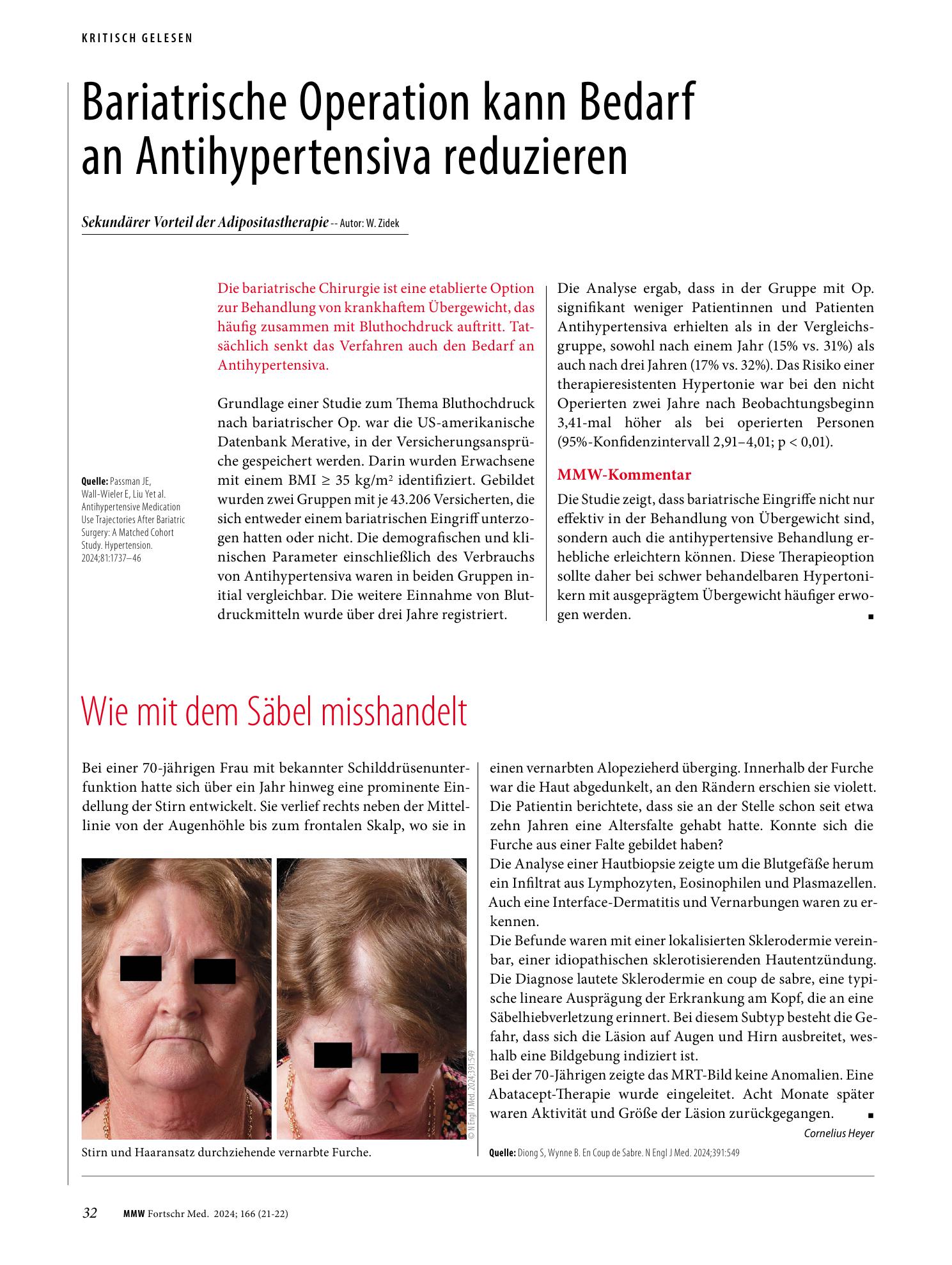 Vorschauseite 1: Wie mit dem Säbel misshandelt