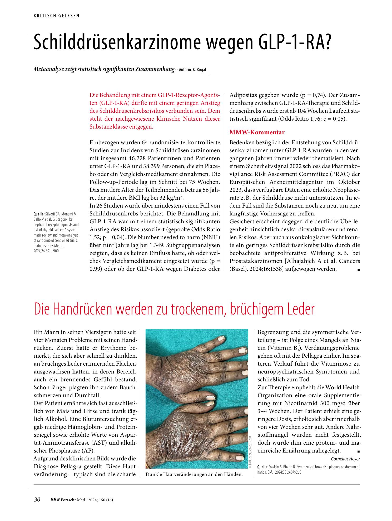 Vorschauseite 1: Schilddrüsenkarzinome wegen GLP-1-RA?