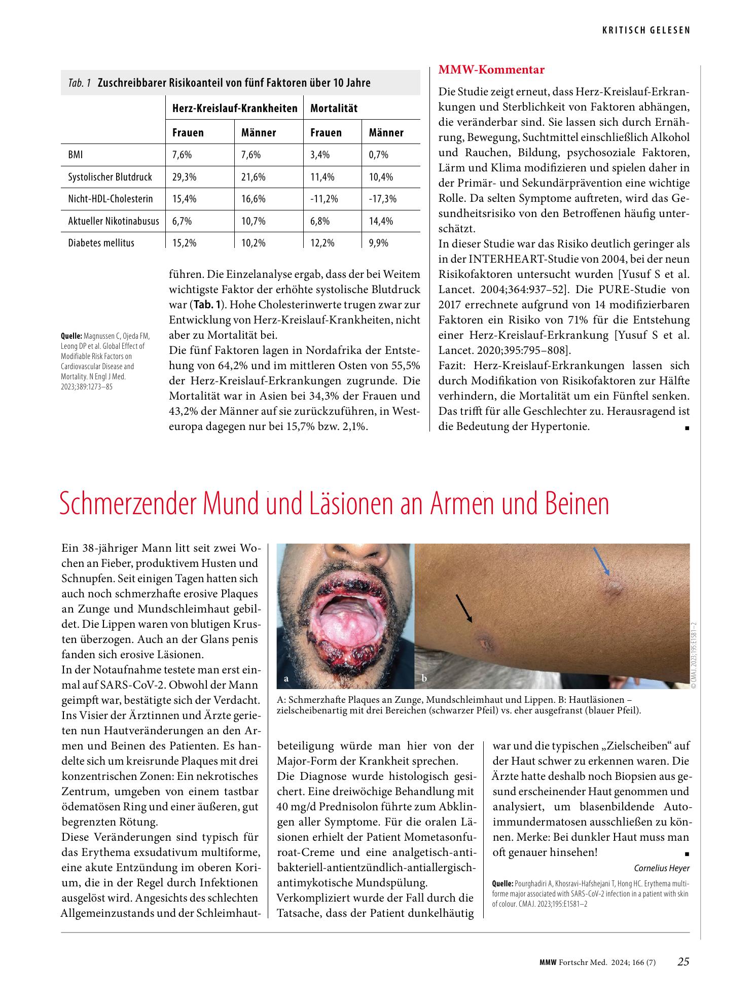 Vorschauseite 1: Schmerzender Mund und Läsionen an Armen und Beinen