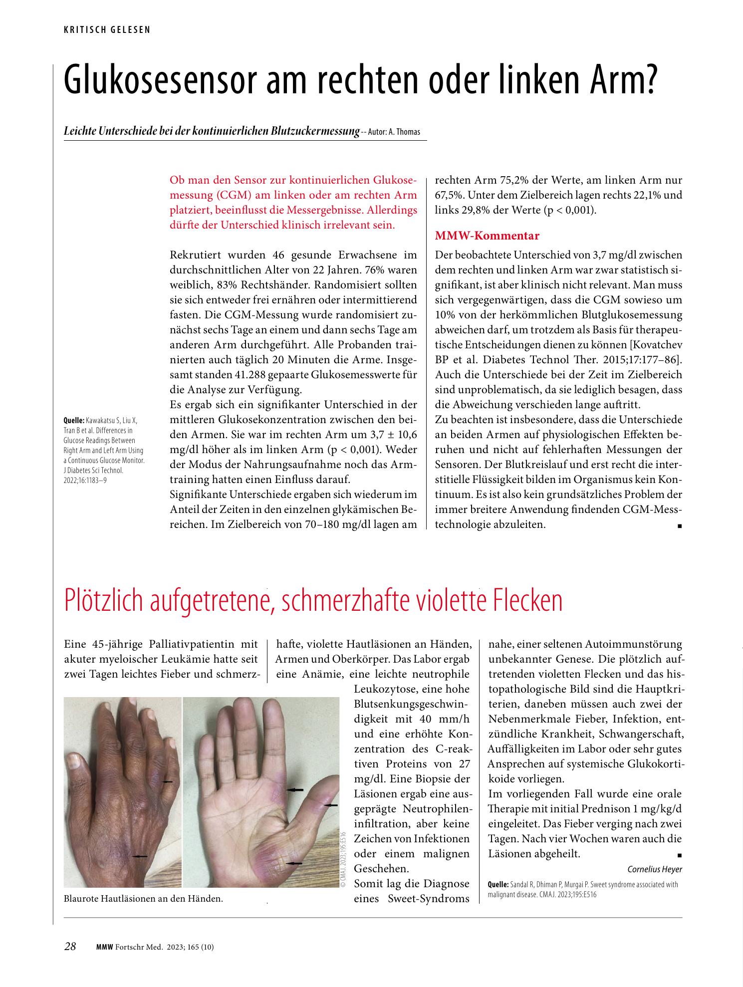 Vorschauseite 1: Plötzlich aufgetretene, schmerzhafte violette Flecken