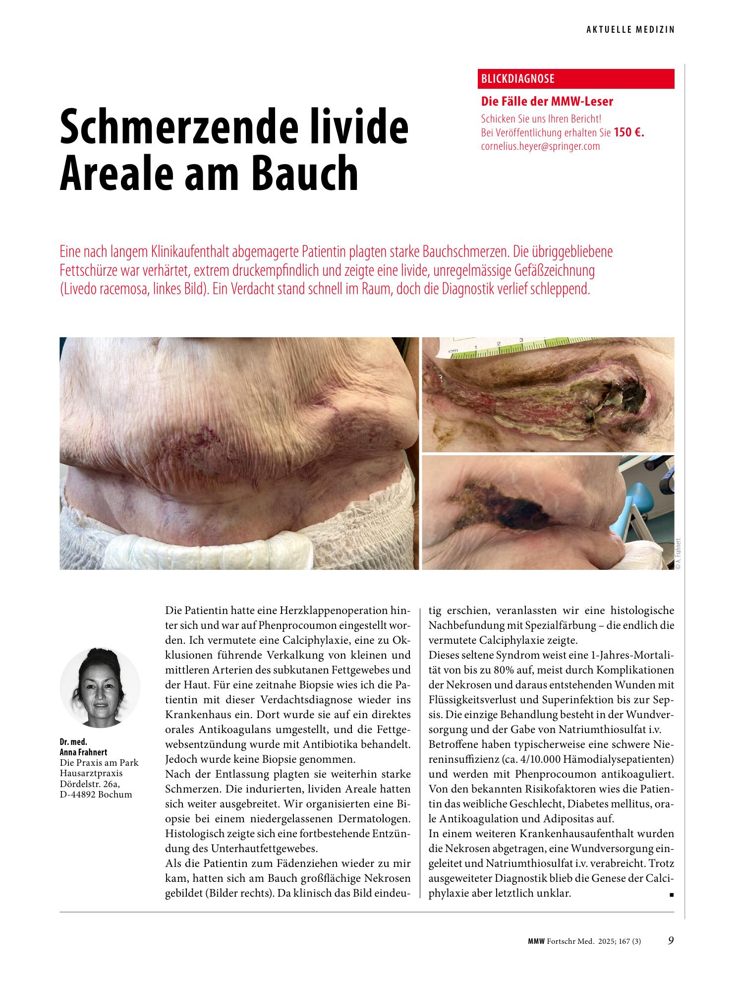 Vorschauseite 1: Schmerzende livide Areale am Bauch