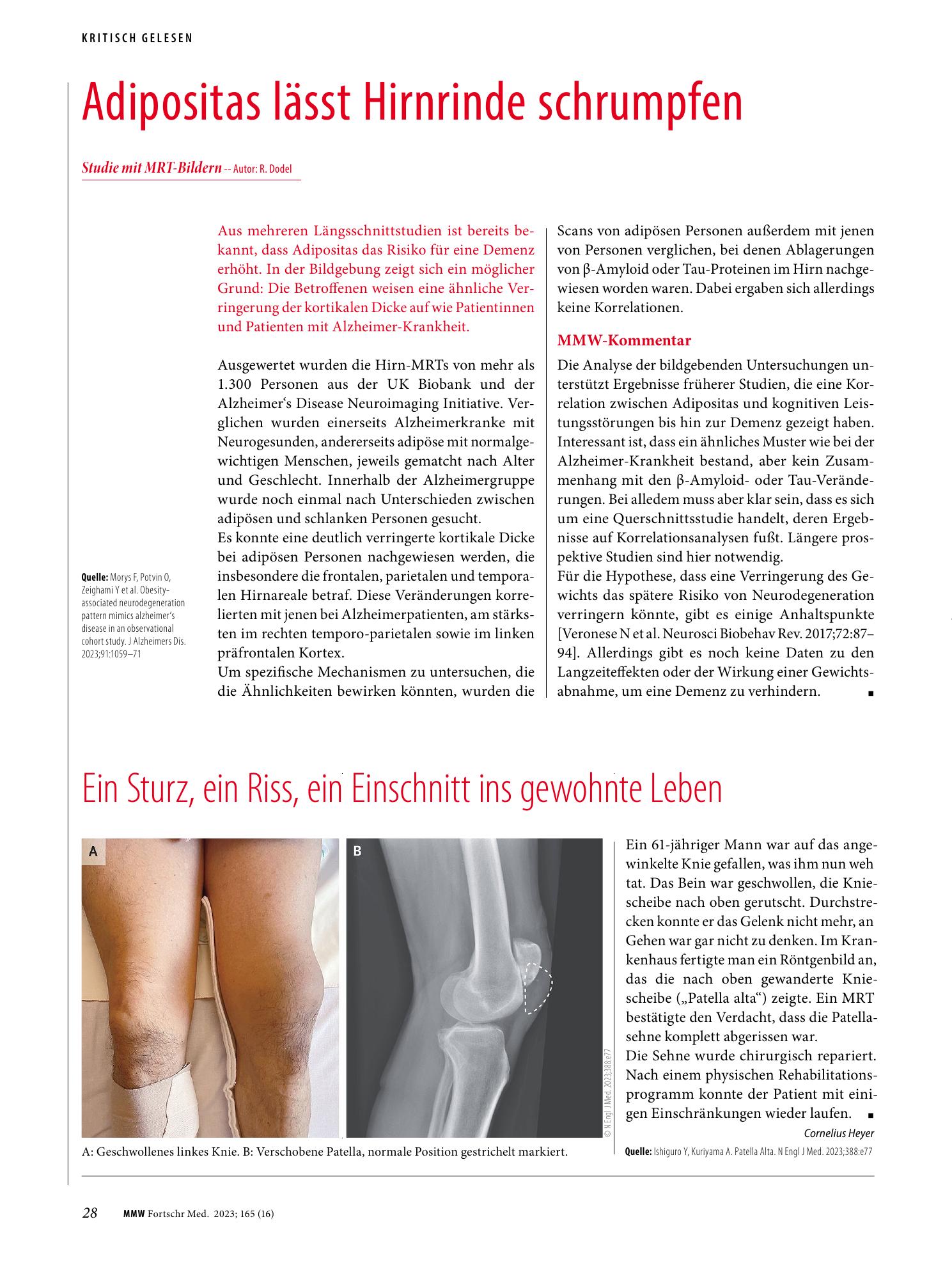 Vorschauseite 1: Ein Sturz, ein Riss, ein Einschnitt ins gewohnte Leben