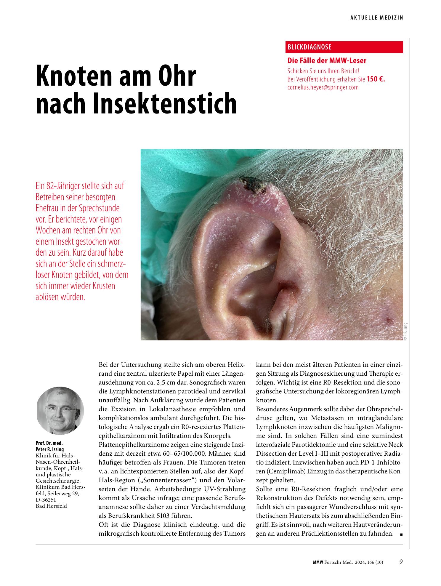 Vorschauseite 1: Knoten am Ohr nach Insektenstich
