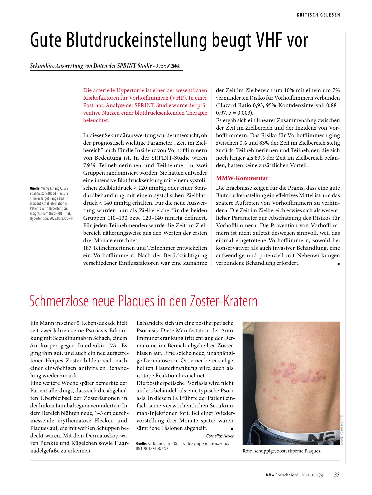Vorschauseite 1: Schmerzlose neue Plaques in den Zoster-Kratern
