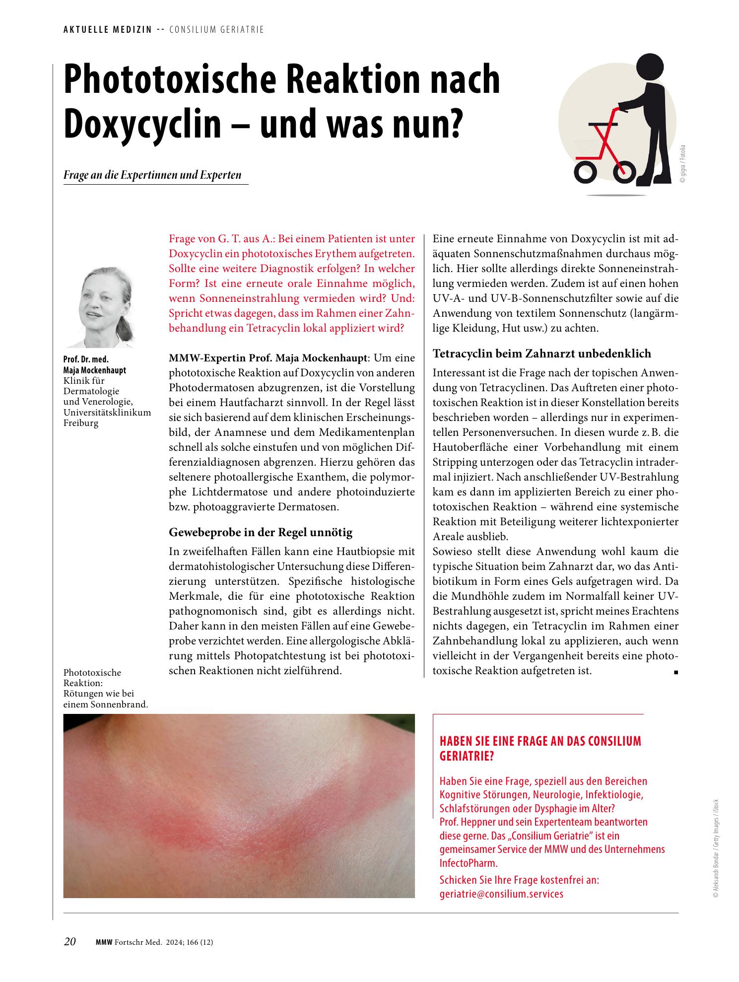 Vorschauseite 1: Phototoxische Reaktion nach Doxycyclin - und was nun?