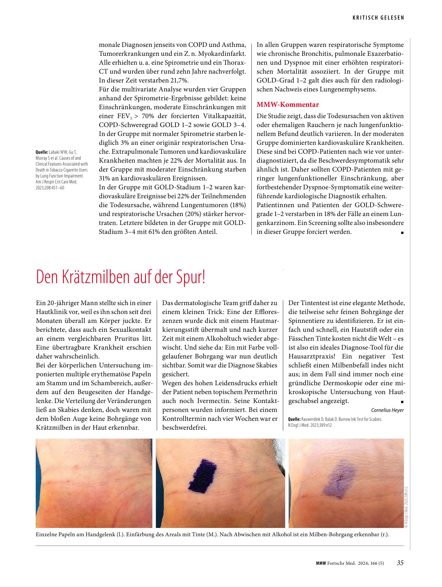 Vorschauseite 1: Den Krätzmilben auf der Spur!