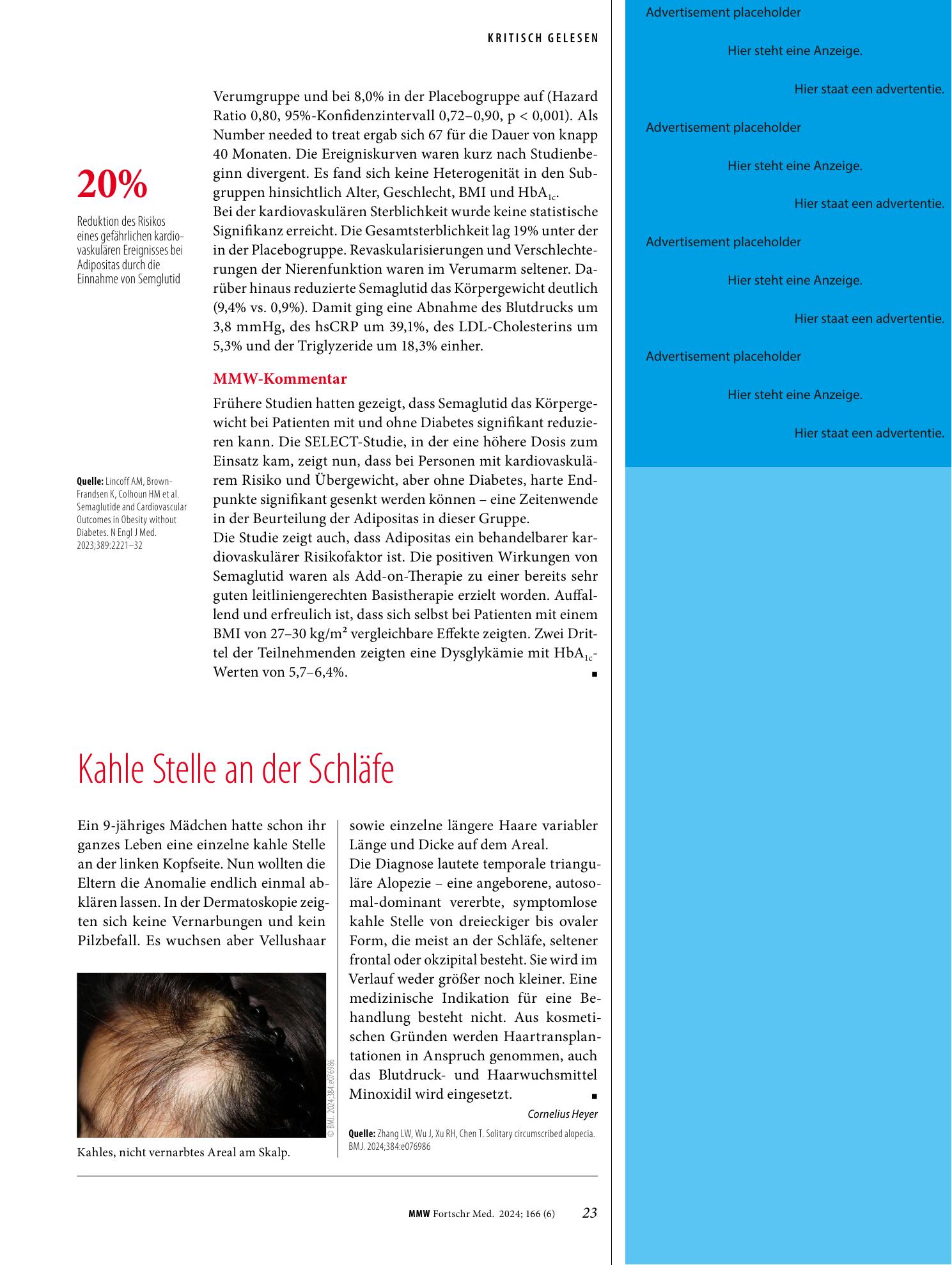 Vorschauseite 1: Kahle Stelle an der Schläfe