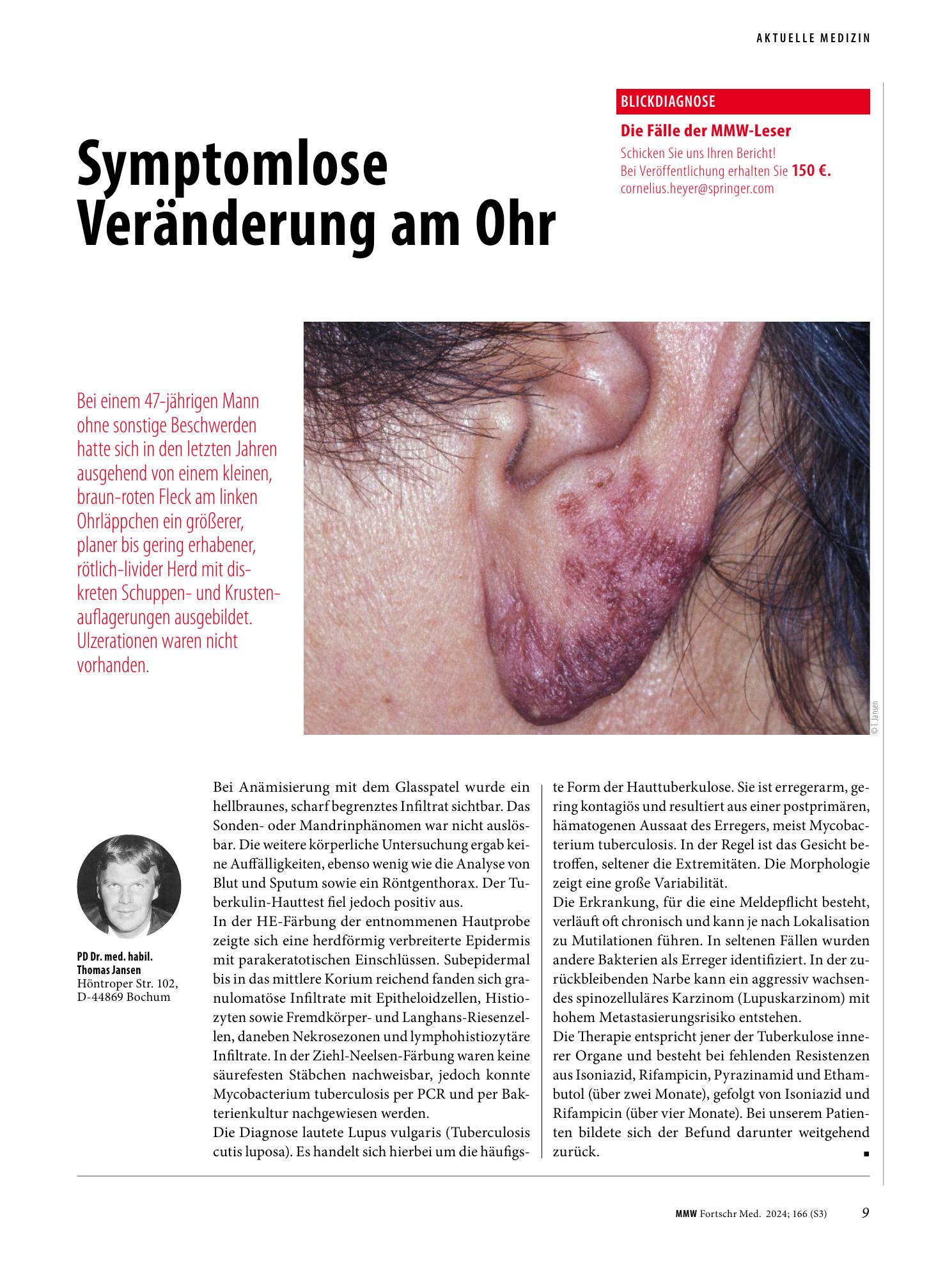 Vorschauseite 1: Symptomlose Veränderung am Ohr
