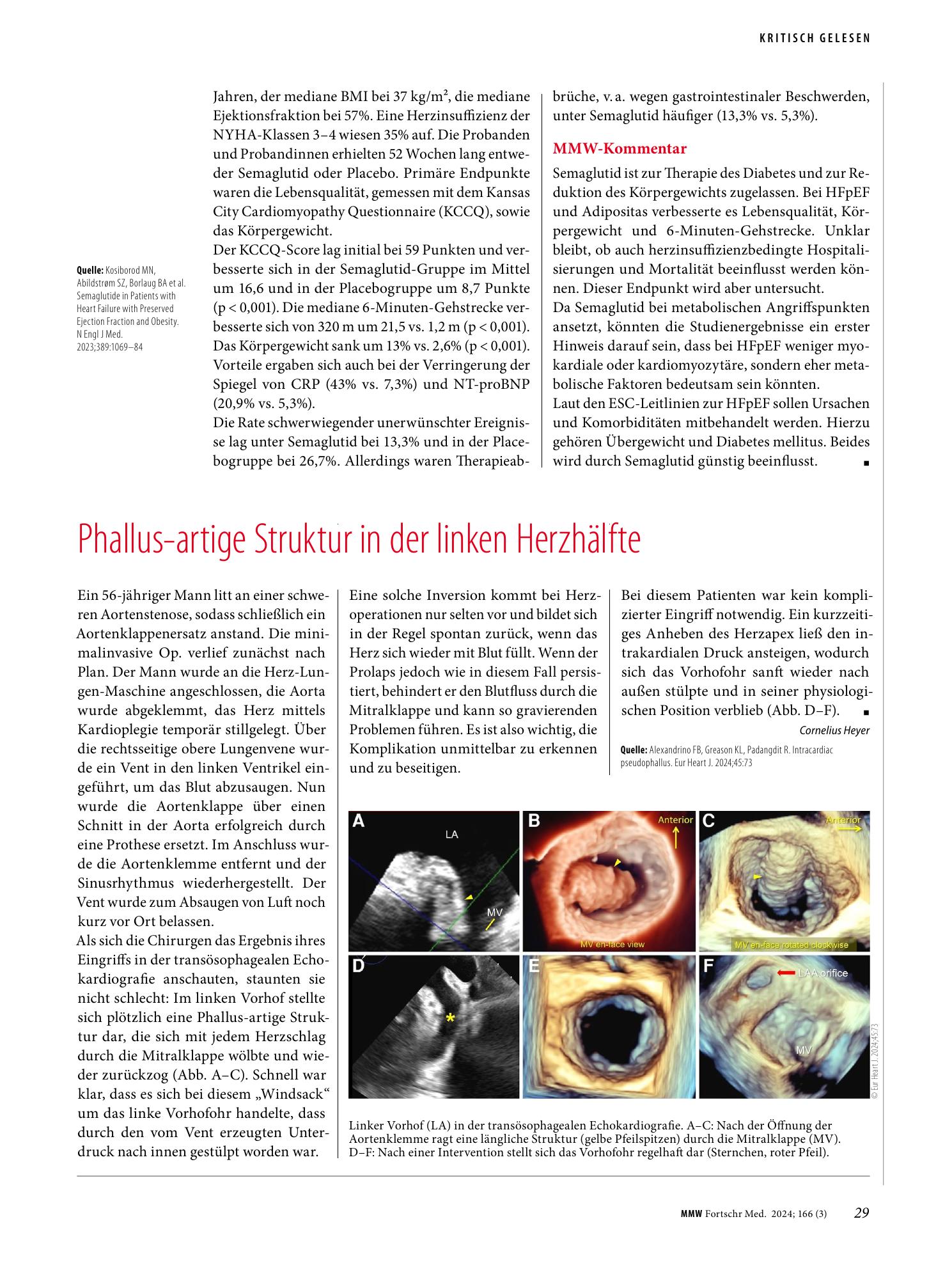 Vorschauseite 1: Phallus-artige Struktur in der linken Herzhälfte