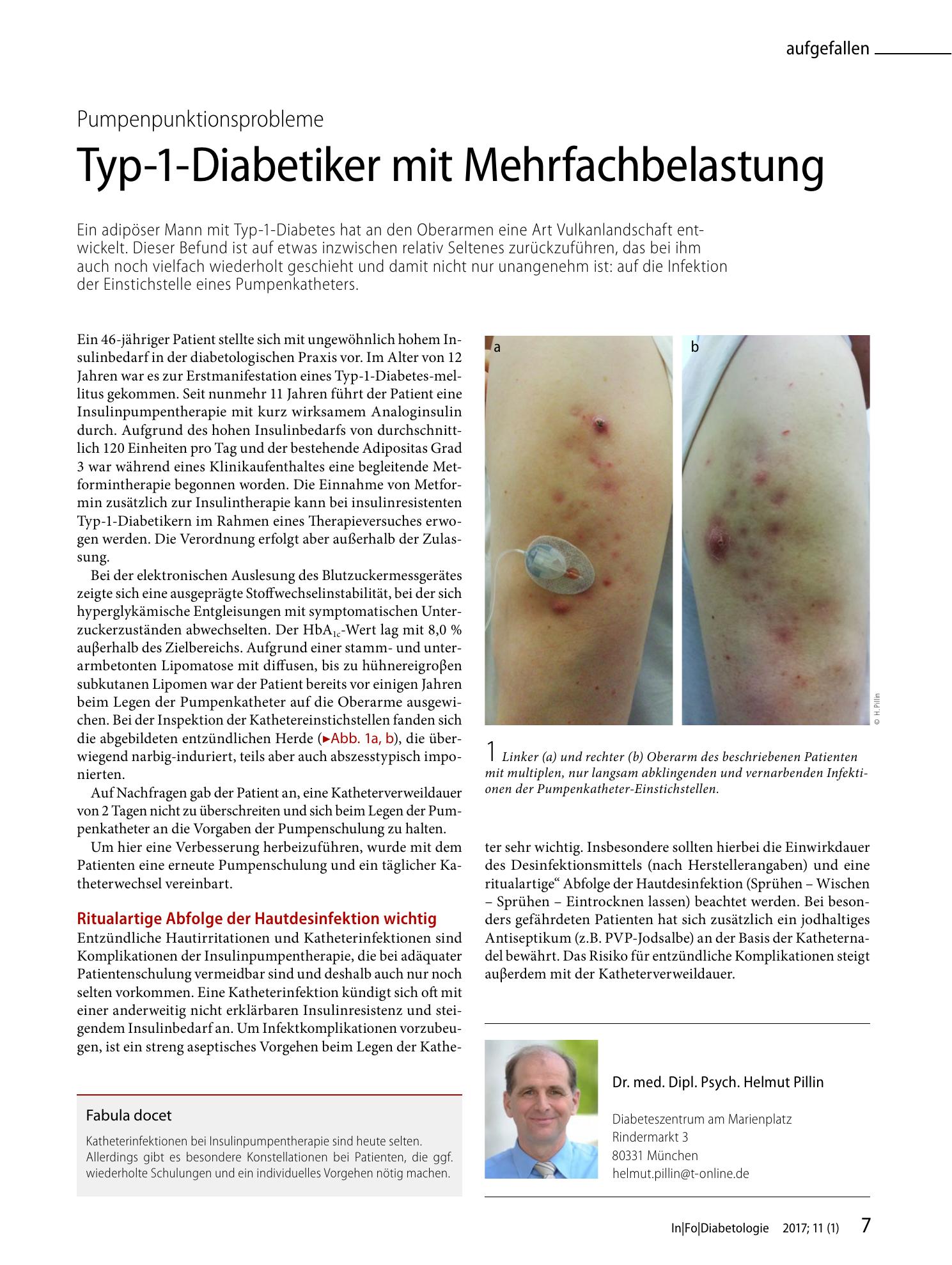 Vorschauseite 1: Typ-1-Diabetiker mit Mehrfachbelastung