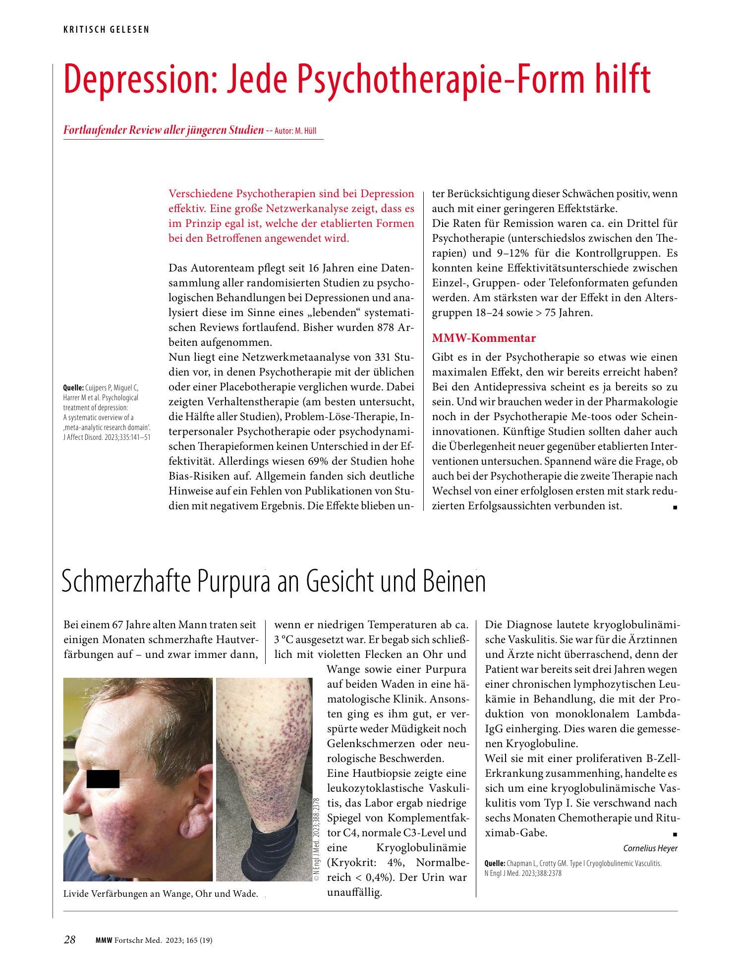 Vorschauseite 1: Depression: Jede Psychotherapie-Form hilft