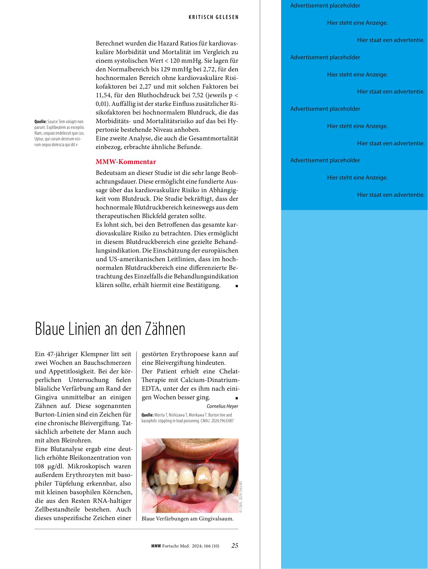 Vorschauseite 1: Blaue Linien an den Zähnen