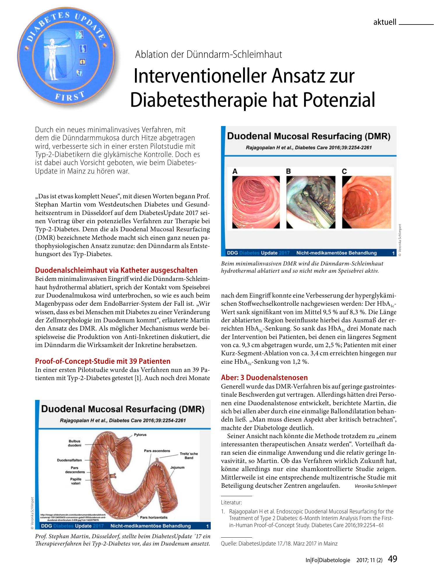 Vorschauseite 1: Interventioneller Ansatz zur Diabetestherapie hat Potenzial