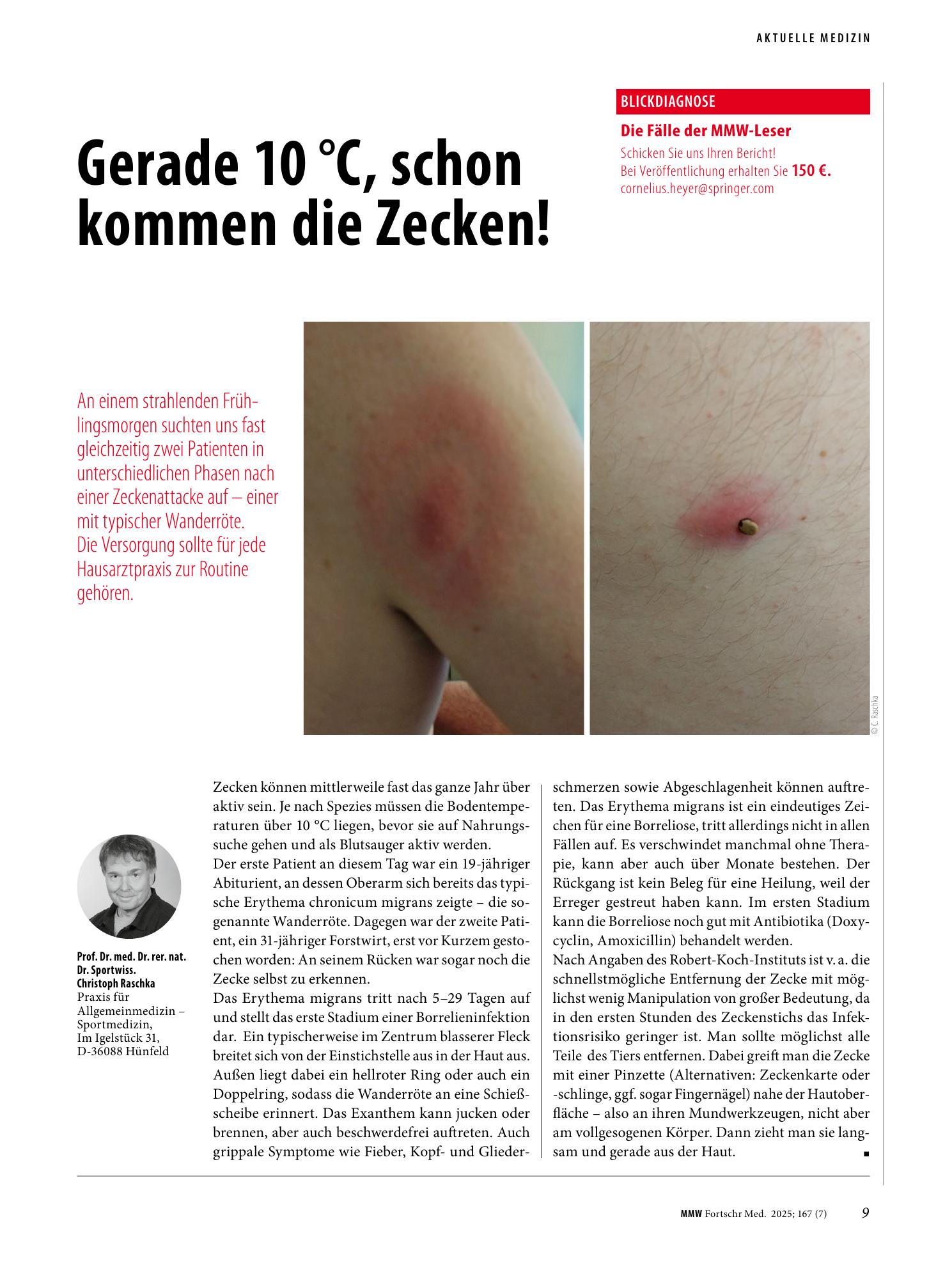 Vorschauseite 1: Gerade 10 °C, schon kommen die Zecken!
