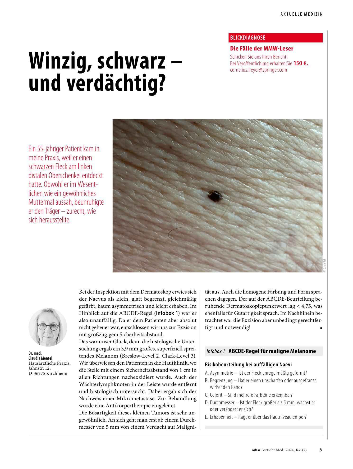 Vorschauseite 1: Winzig, schwarz - und verdächtig?